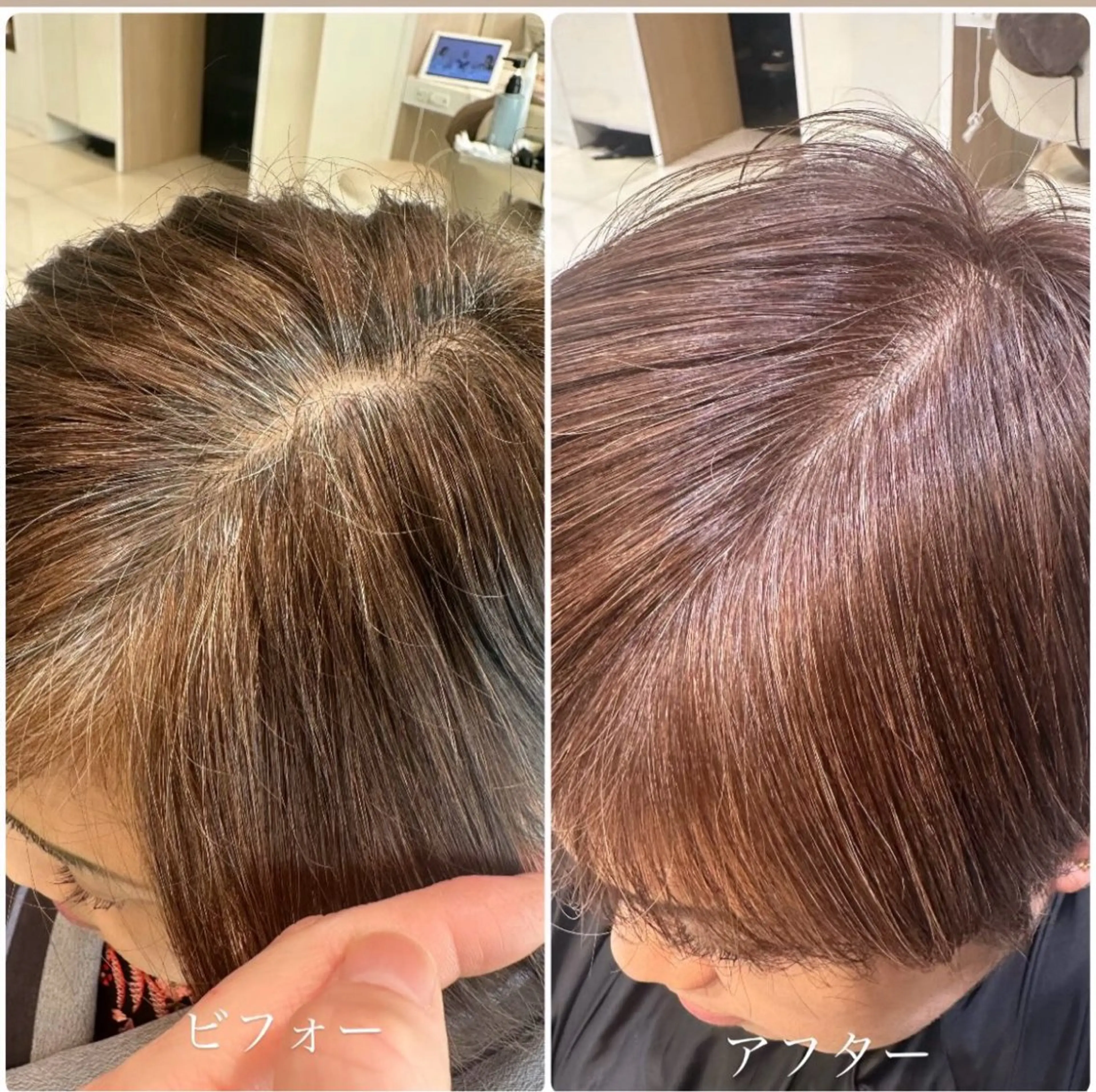 白髪ぼかし+クイックトリートメントの写真