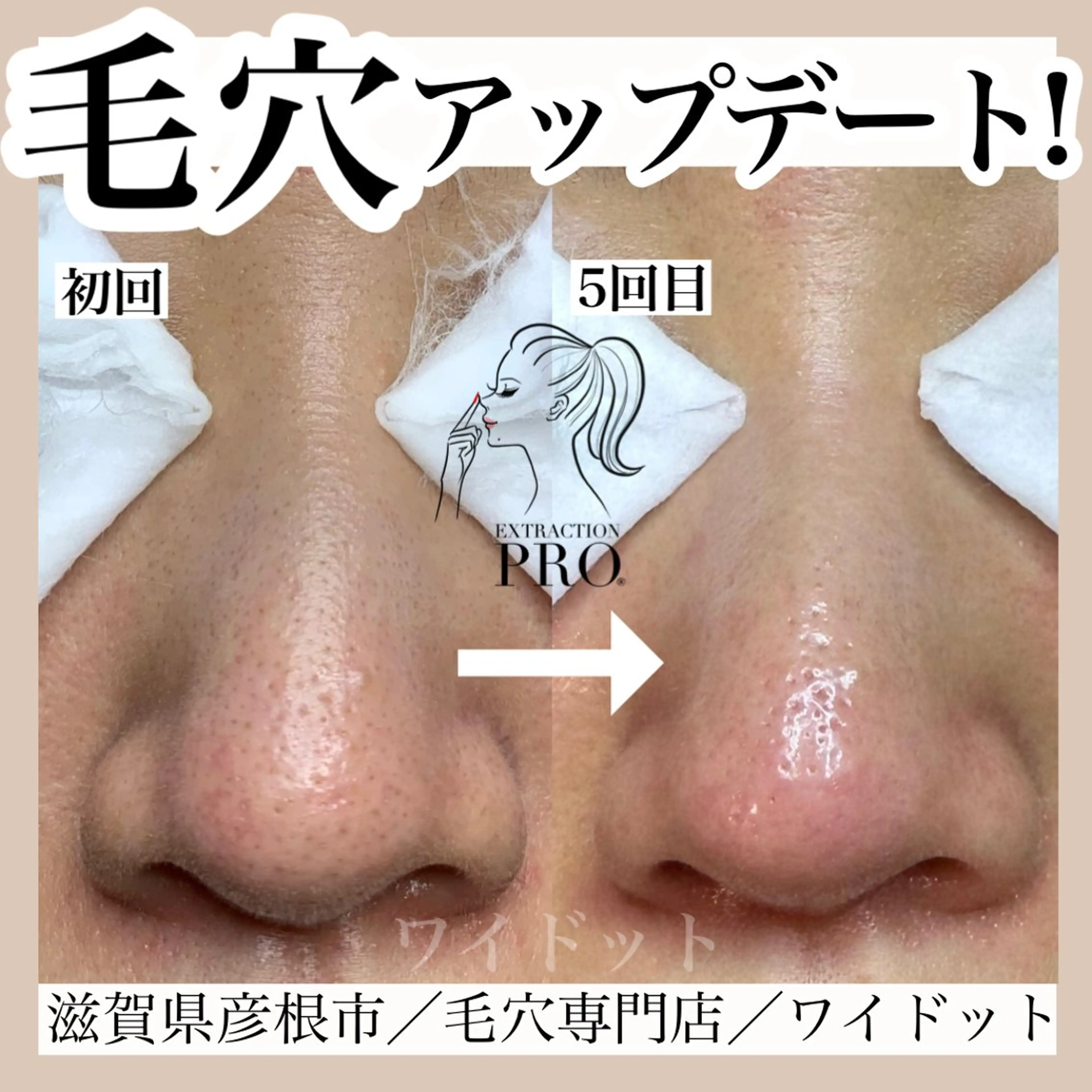 エステ Ydot. 池内 友架のエステ・リラクイメージ