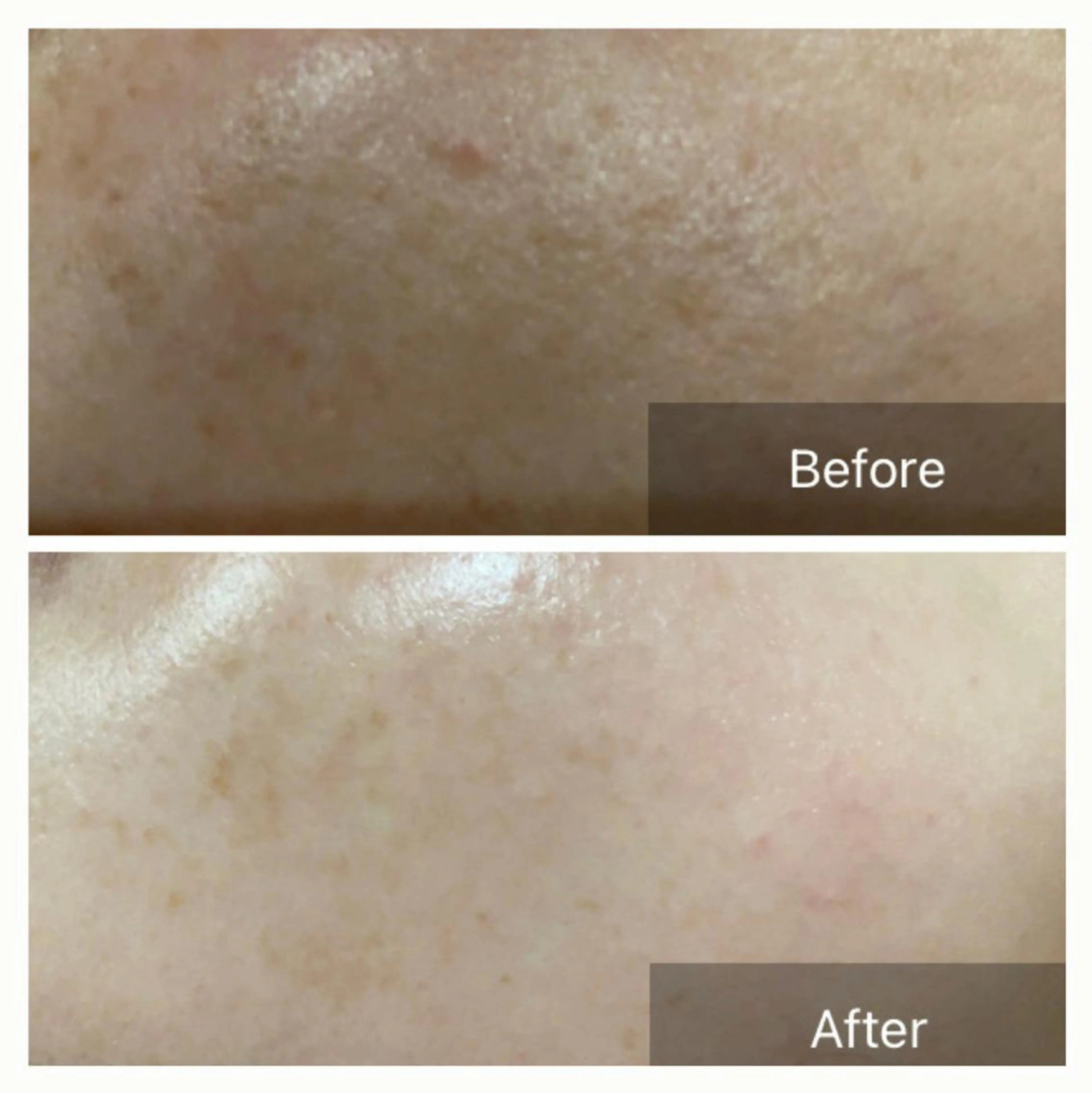 エステ Lumiere despoir所属・Lumiere despoirのエステ・リラクイメージ