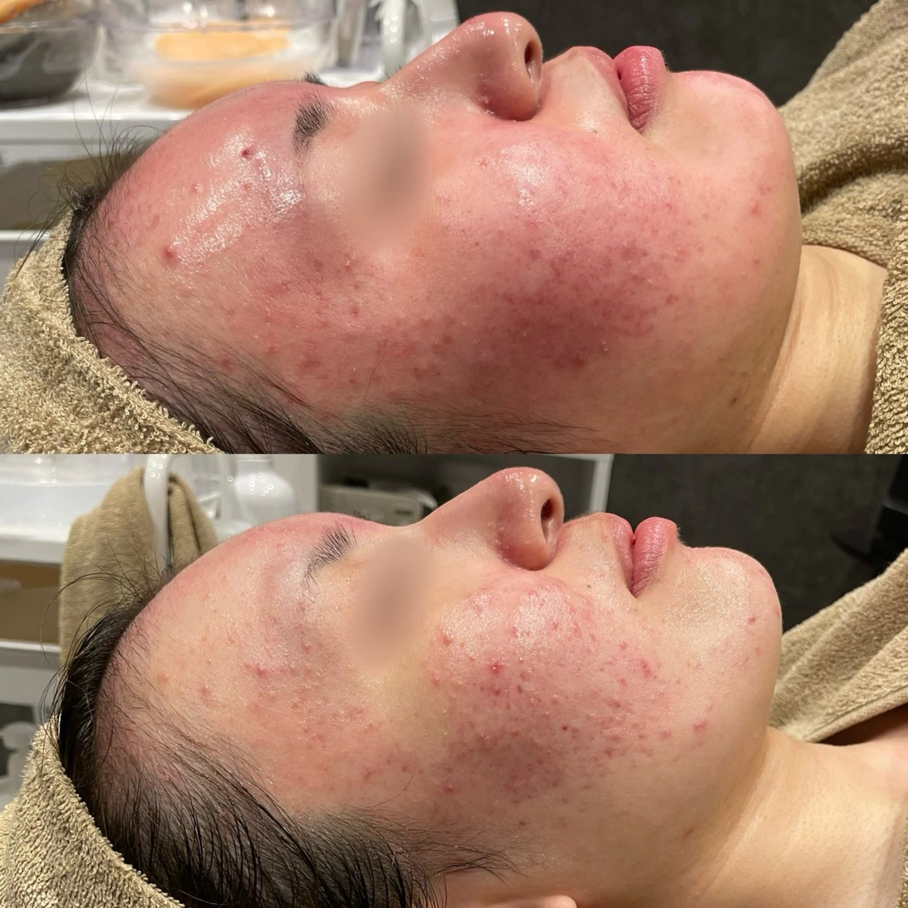 エステ Re:Belle所属・Re:Belle 久留米 : 中島のエステ・リラクイメージ