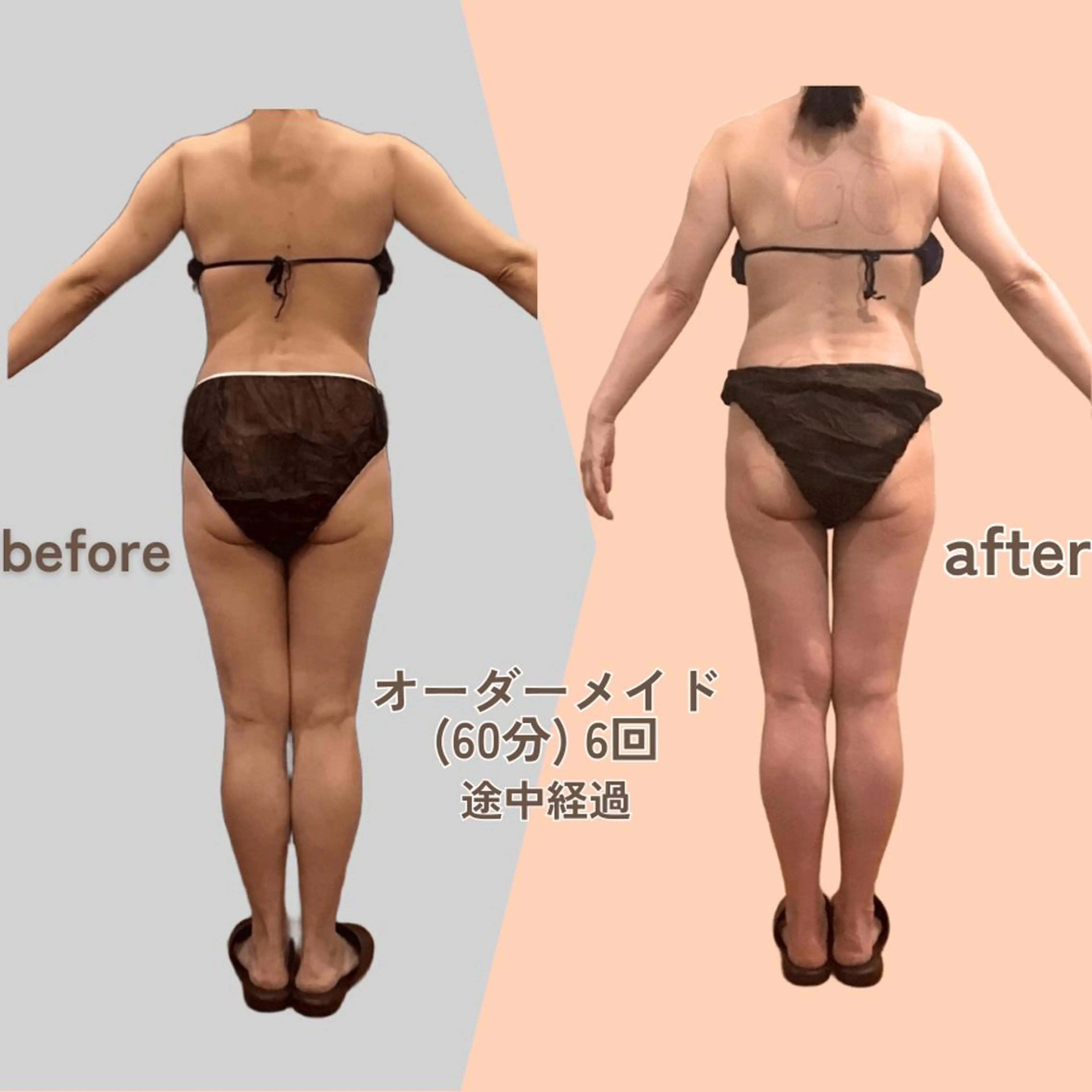 痩身エステ Julien麹町店のエステ・リラクイメージ