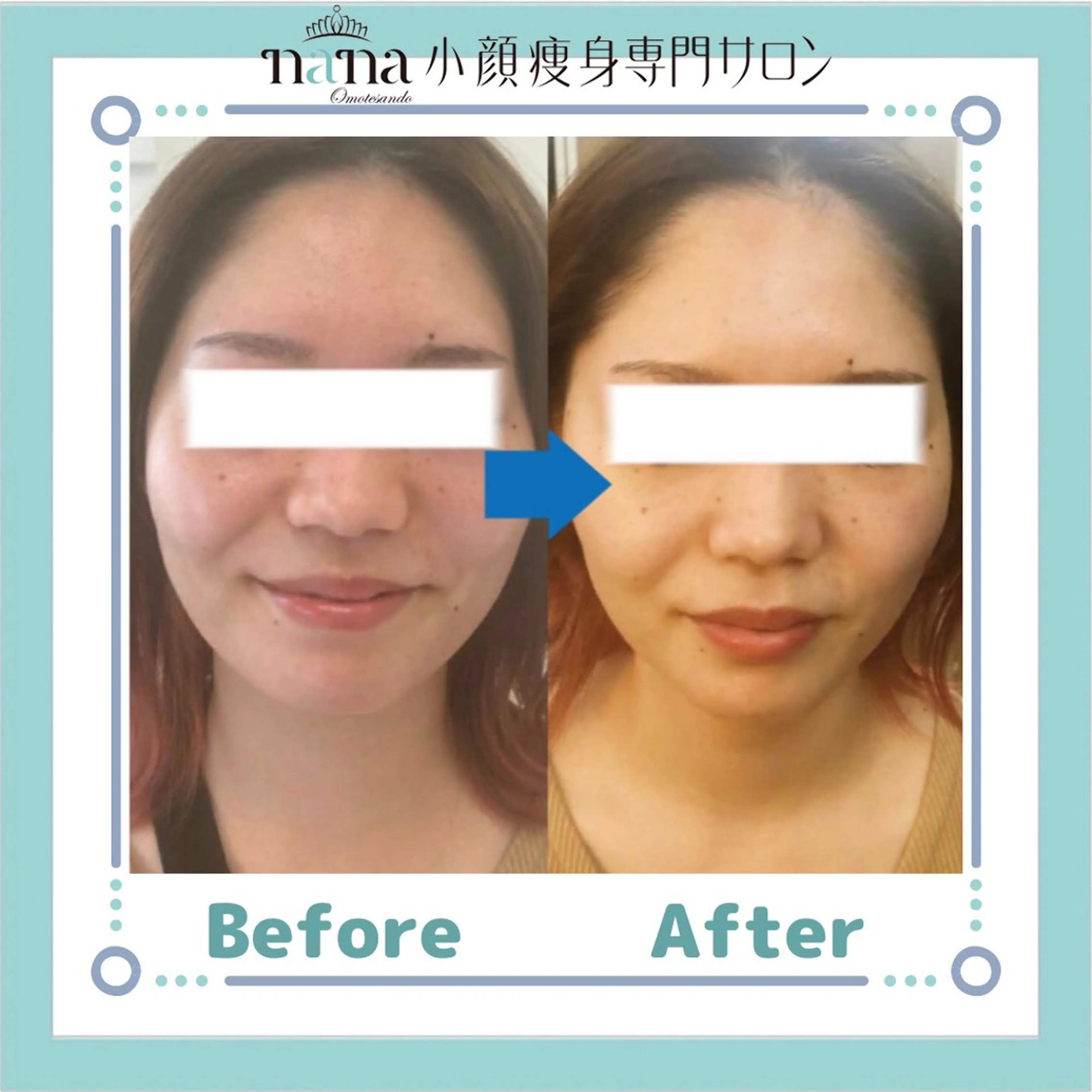 小顔痩身インディバ Nana表参道のエステ・リラクイメージ