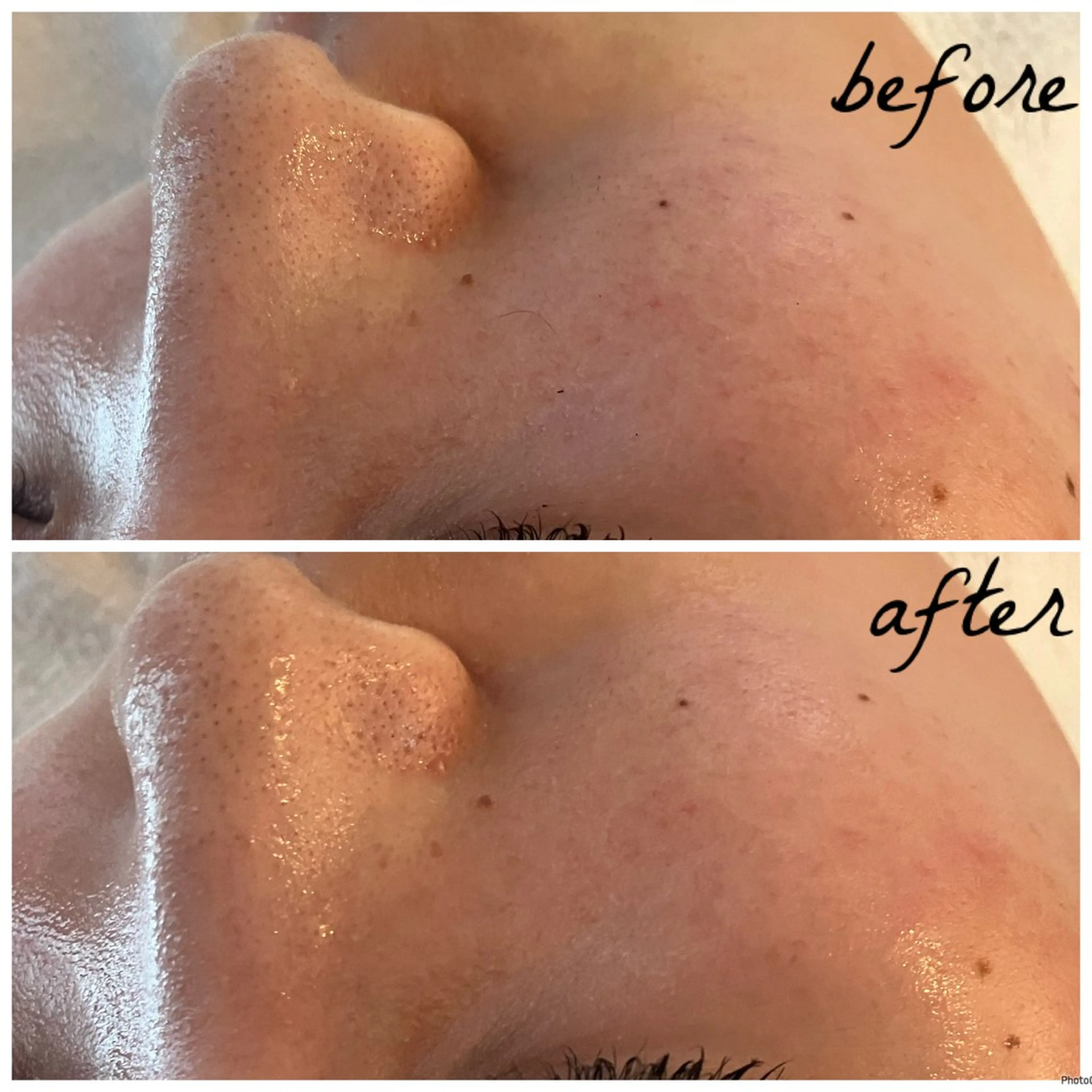 メンズ メナード岐阜茜部 杉浦のエステ・リラクイメージ