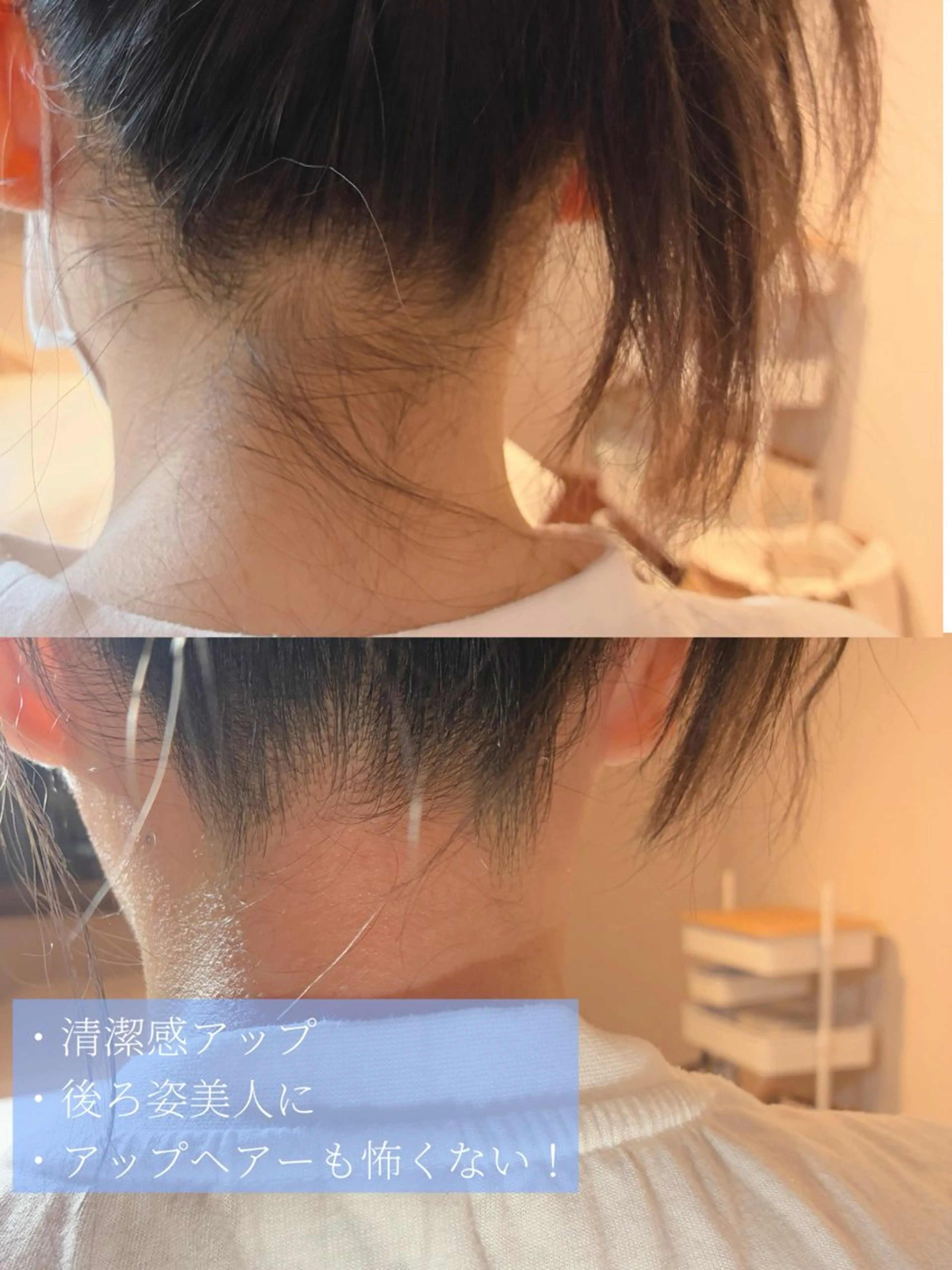脱毛 Erika komorebi_のエステ・リラクイメージ
