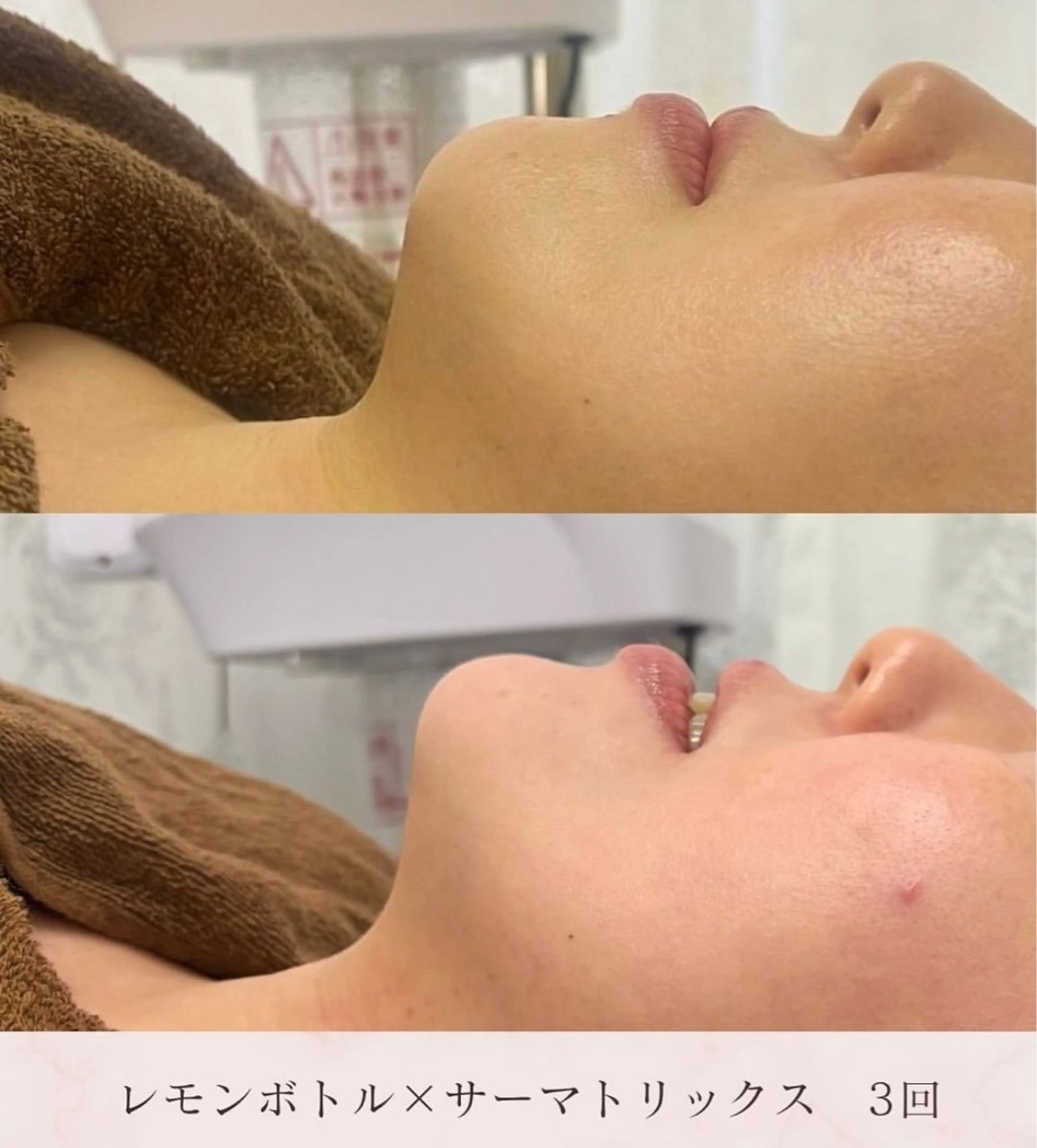 エステ 毛穴レス美肌へ🌿 看護師Abe🌼のエステ・リラクイメージ