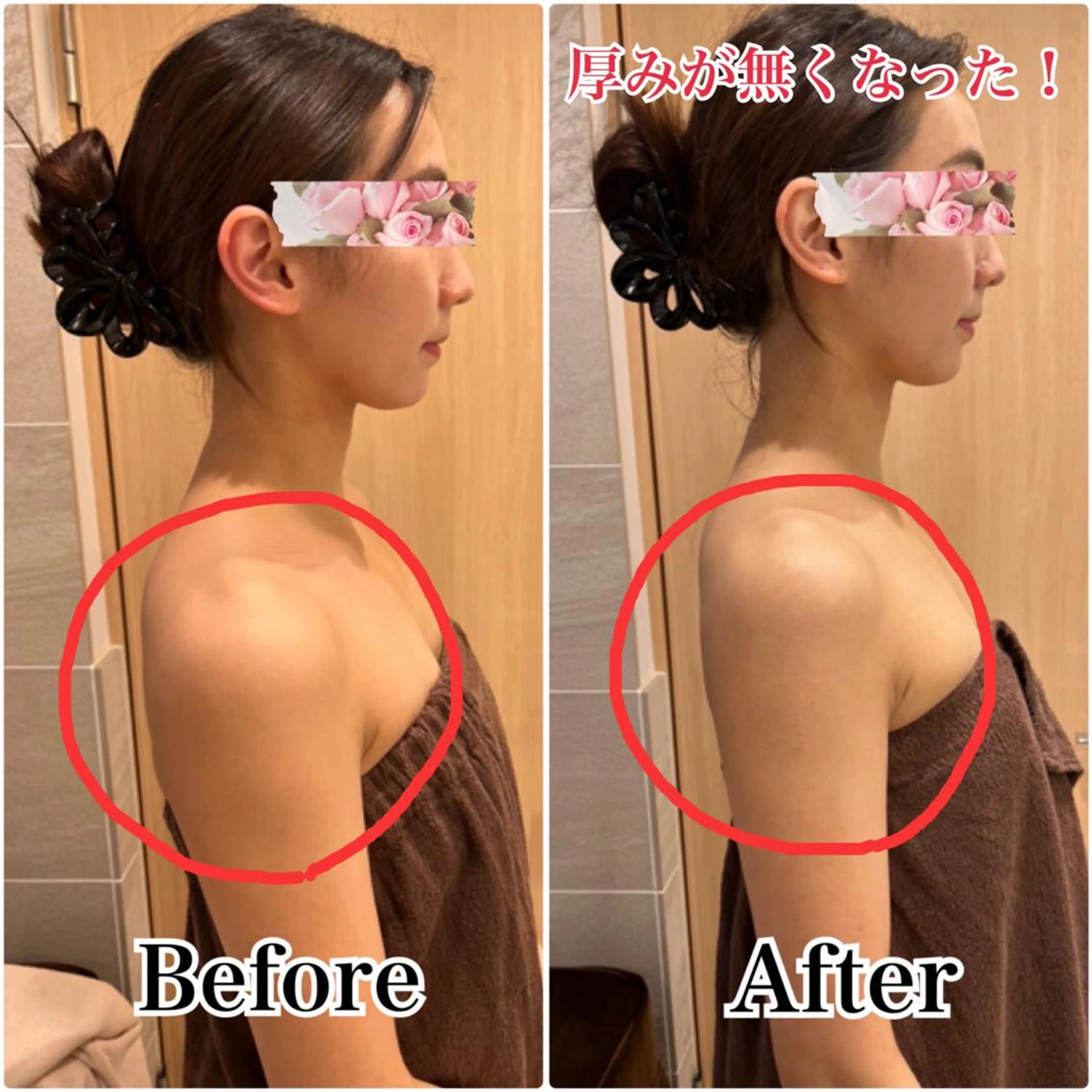 痩身×フェイシャル ブライダル|Linoのエステ・リラクイメージ