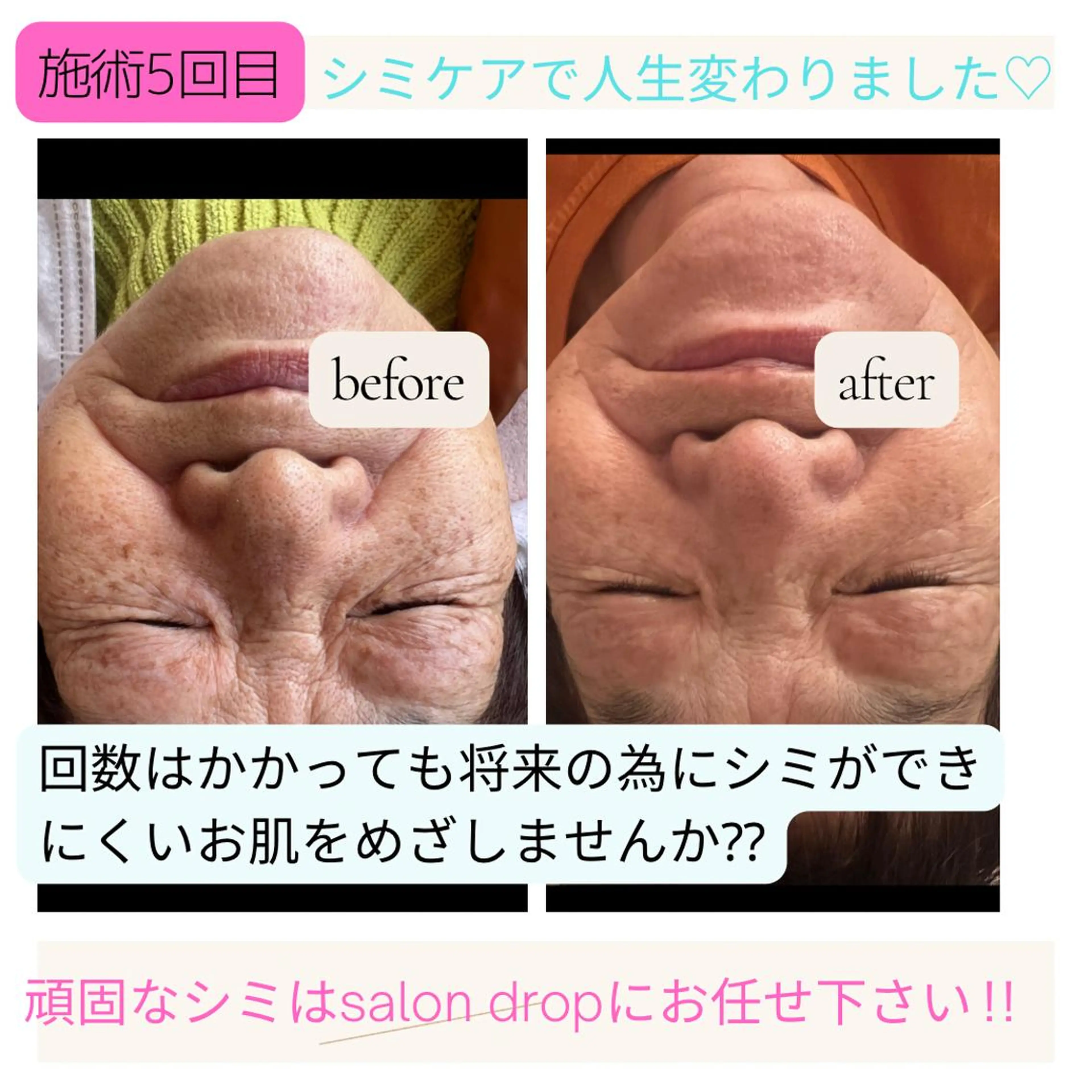 salon＿drop所属・salon dropのエステ・リラクイメージ