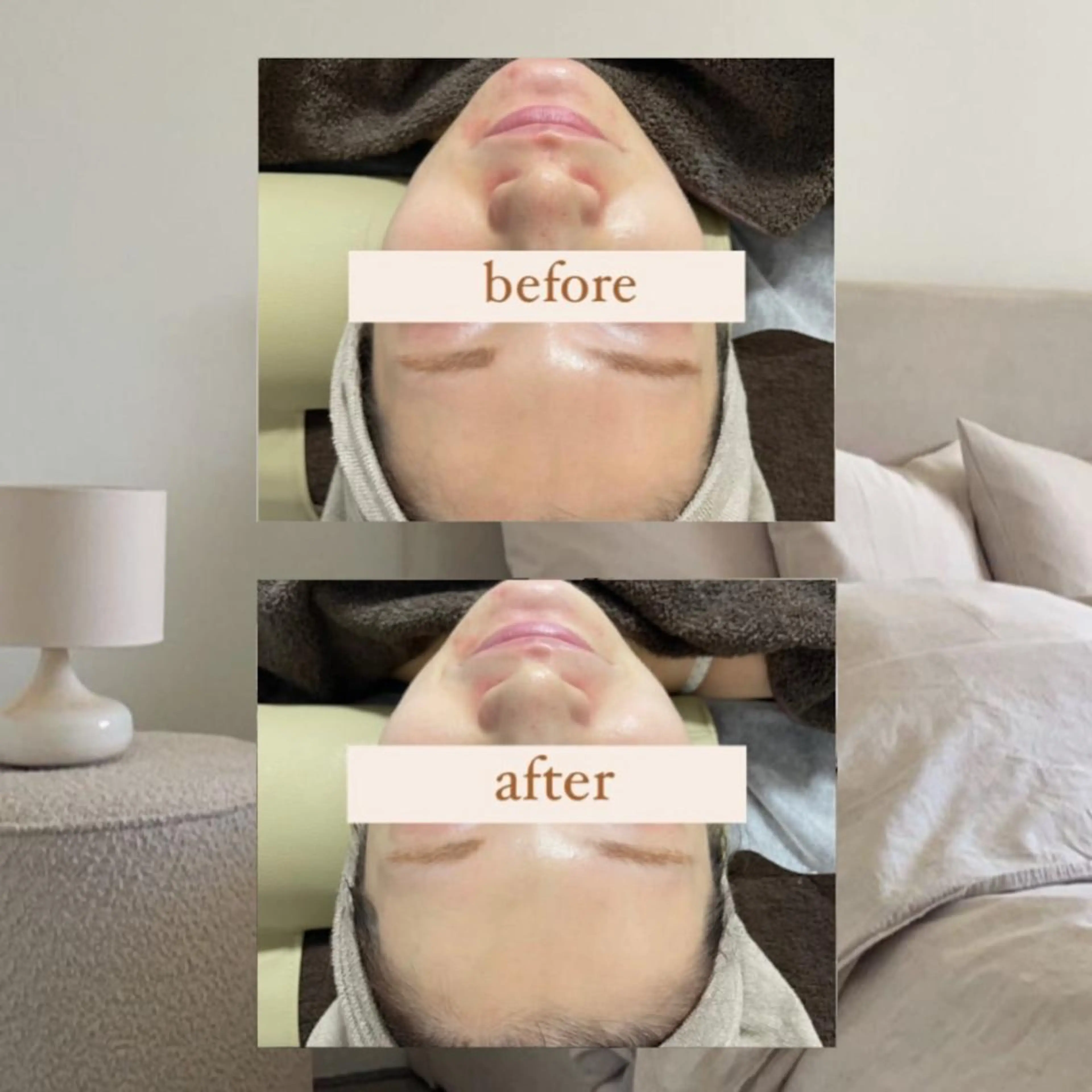 エステ crescent所属・【韓国肌管理・脱毛】 クレセントのエステ・リラクイメージ