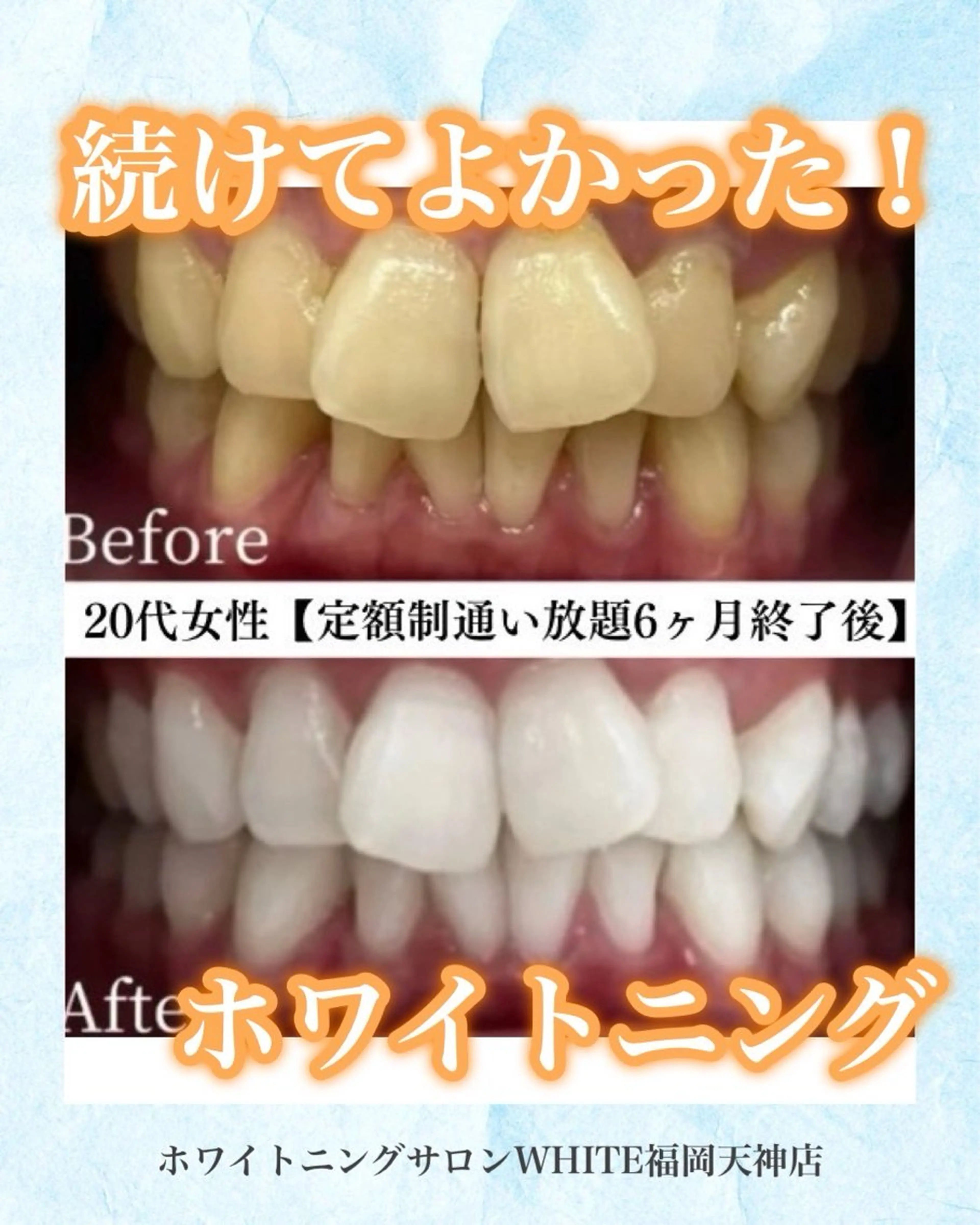 メンズ キッズ 撮影モデル ホワイトニング専門店 WHITE天神店のエステ・リラクイメージ