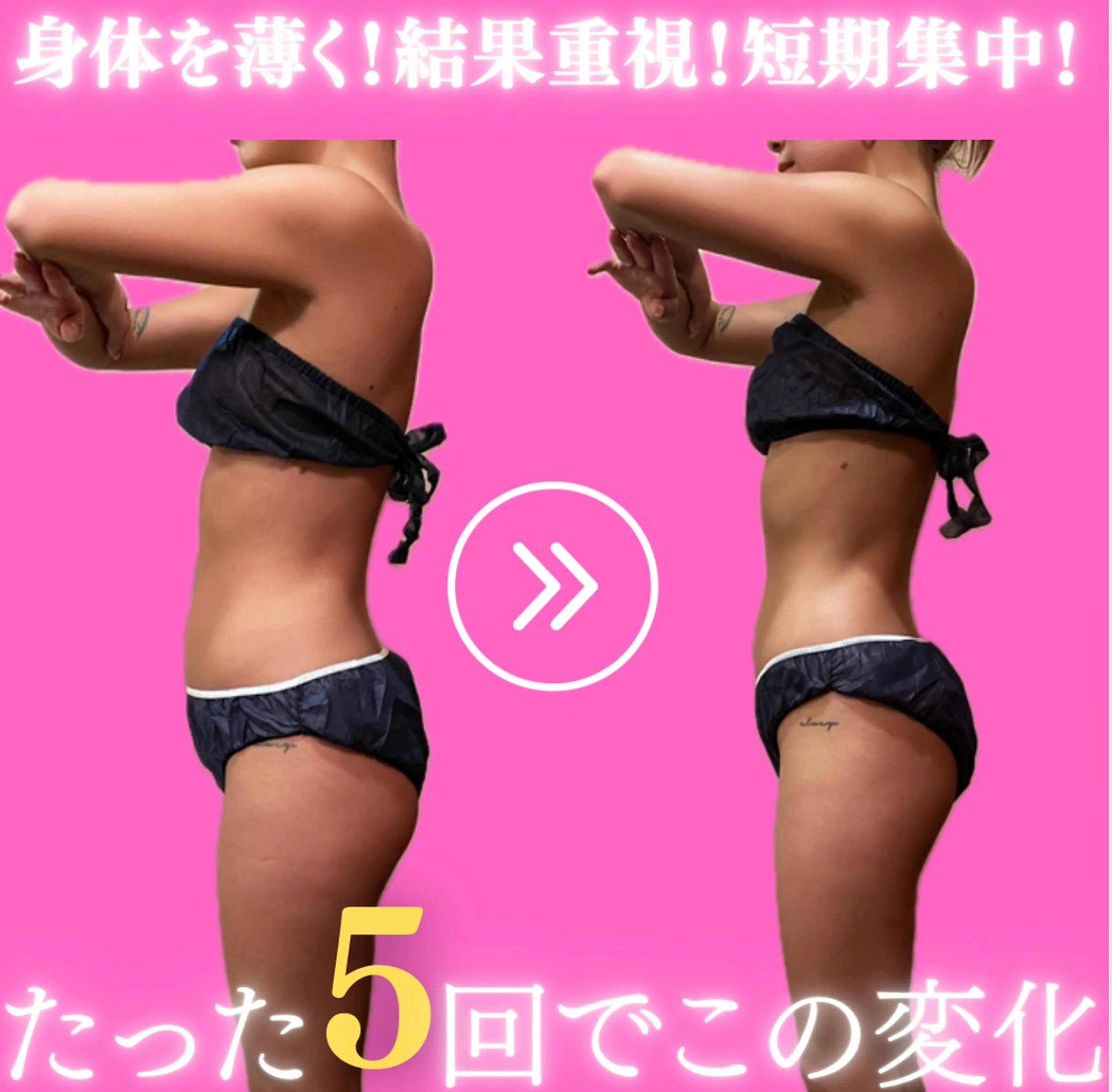 【圧倒効果🌟】リバウンドしない身体作り✨気になる二の腕・太もも・下腹部など落ちずらい箇所を最短で落とす❣️の写真