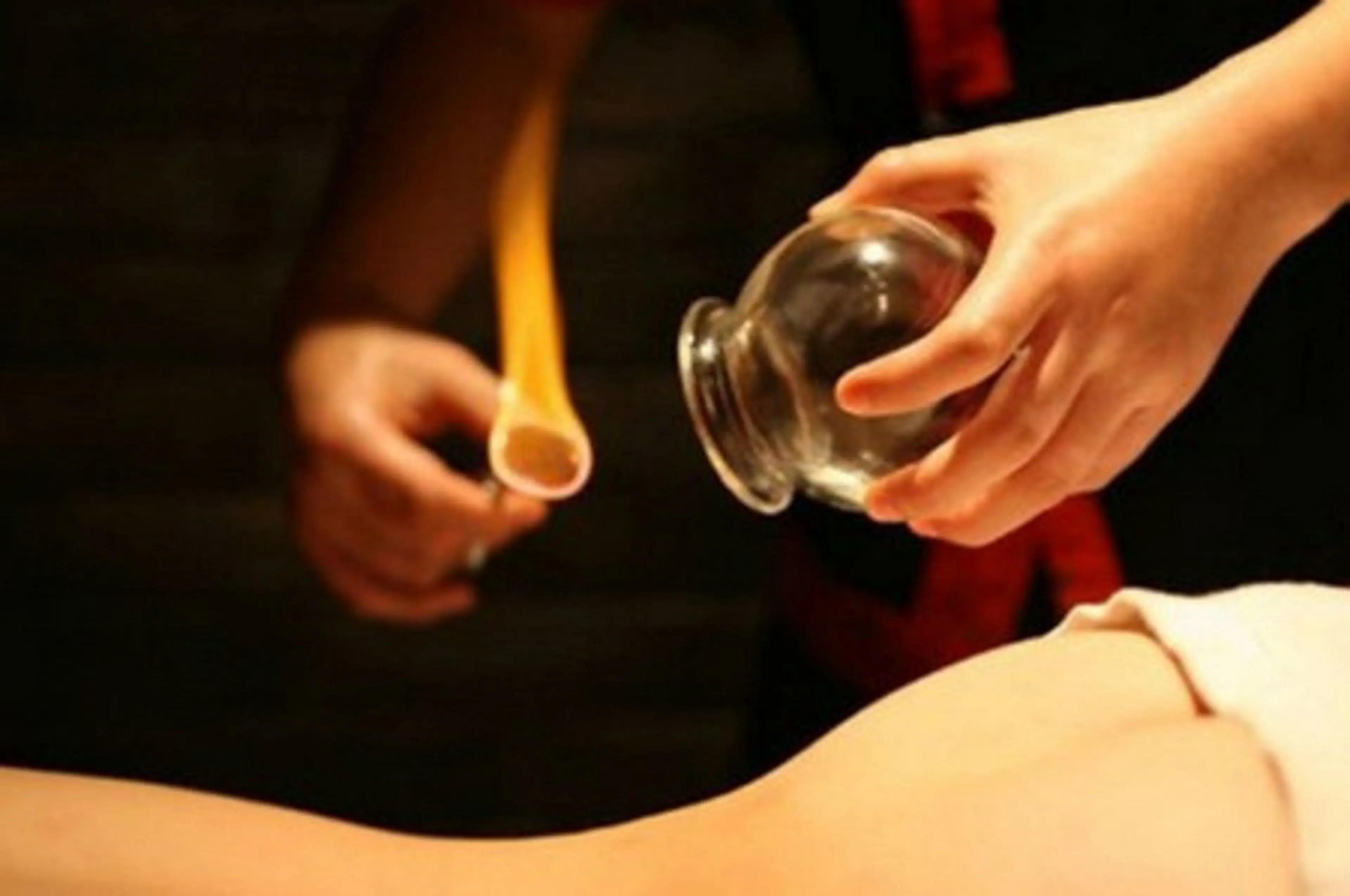 カッピング30分¥3000の写真