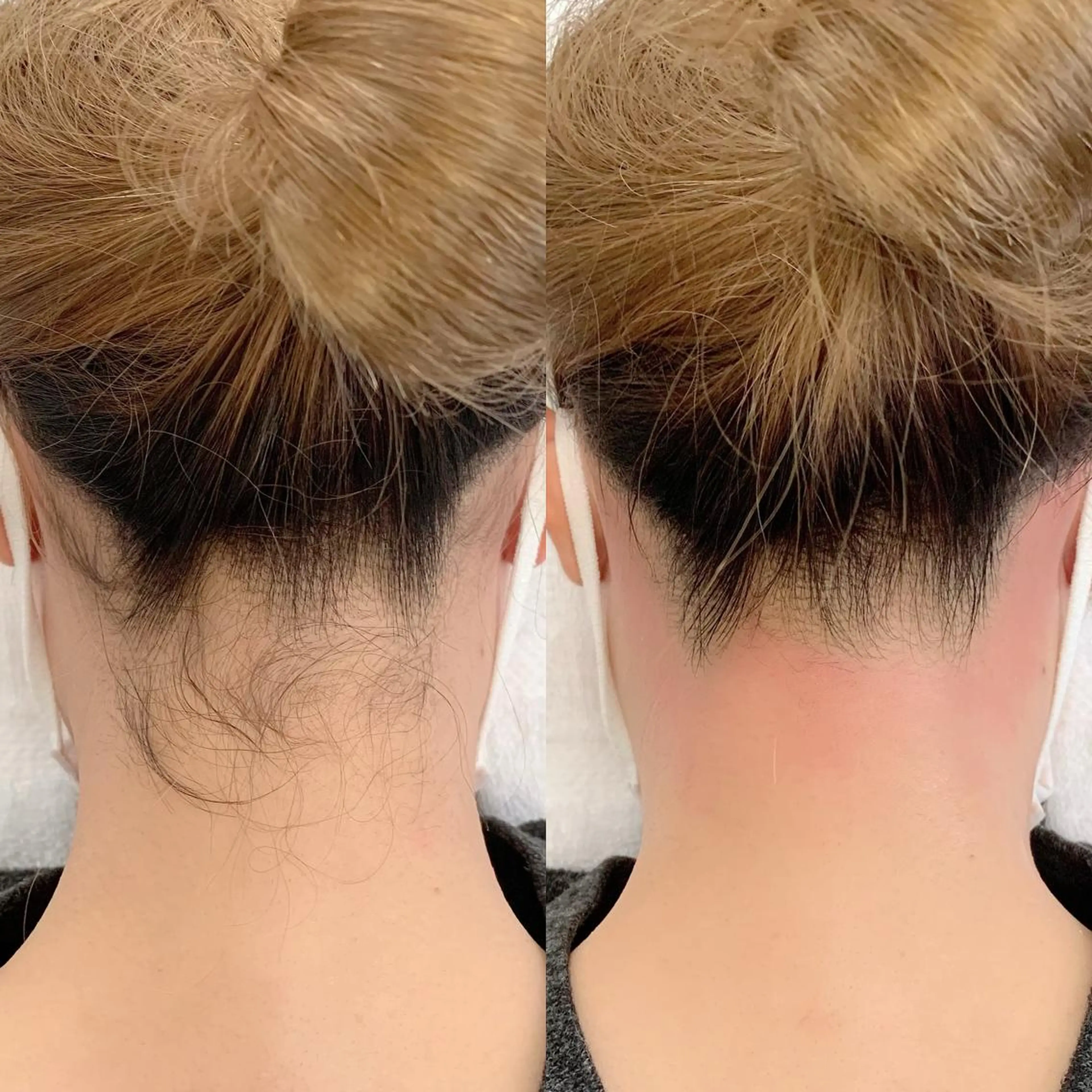 脱毛 salonLADYSTYLE所属・稲嶺 美華のエステ・リラクイメージ