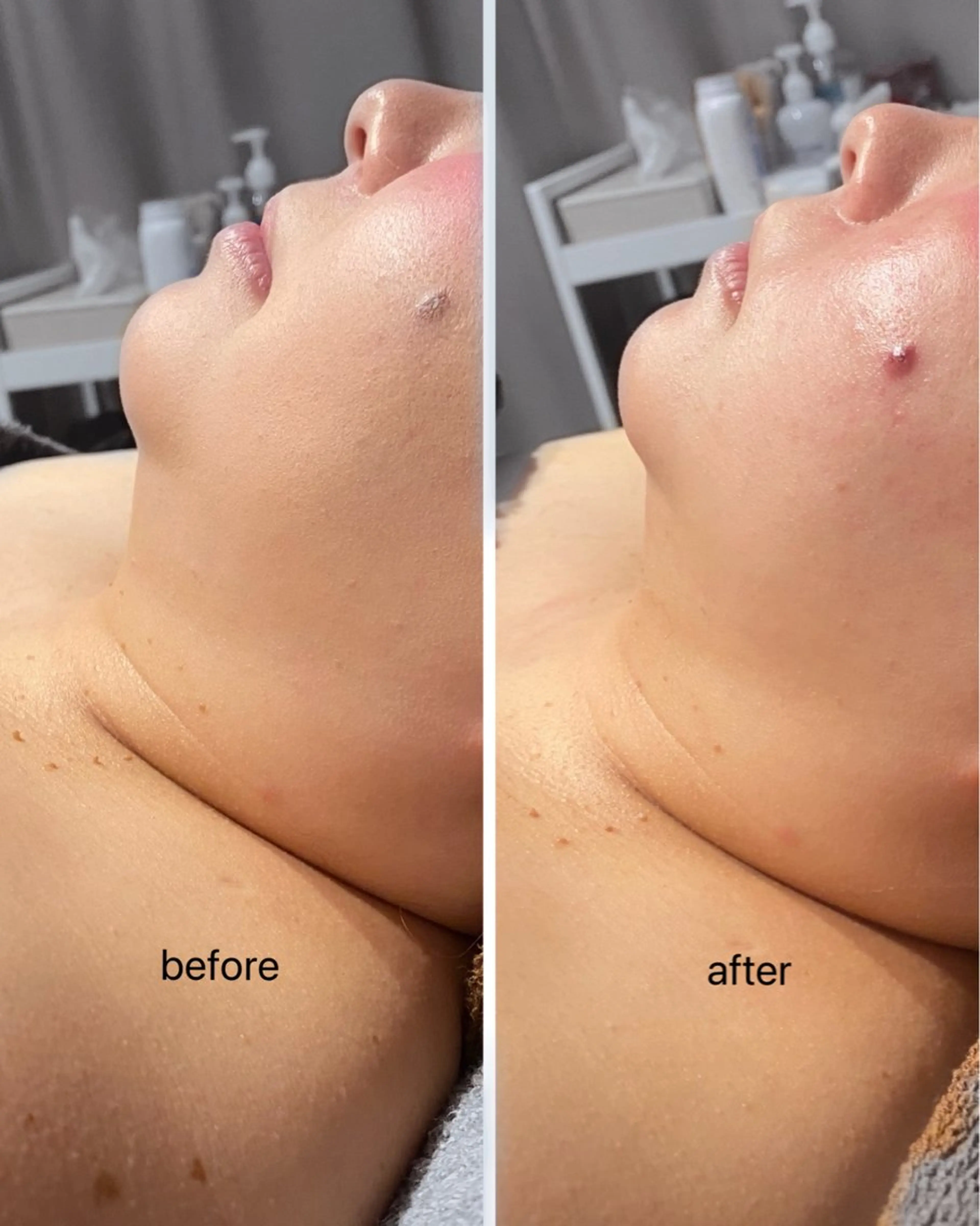 エステ 【痩身・脱毛サロン】 REBISKIN🌱のエステ・リラクイメージ