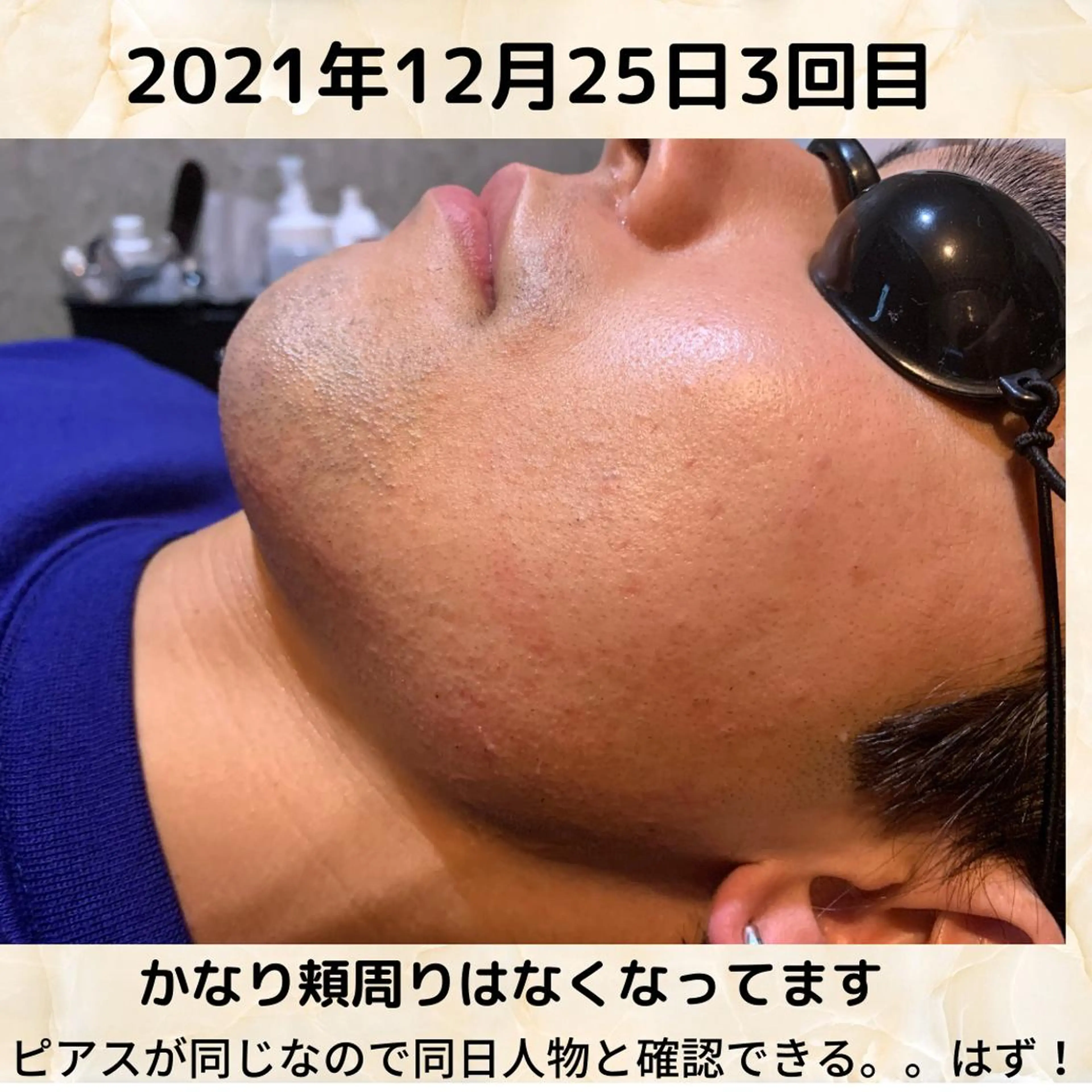 メンズ 20代から始める脱毛 salonLEPIAのエステ・リラクイメージ