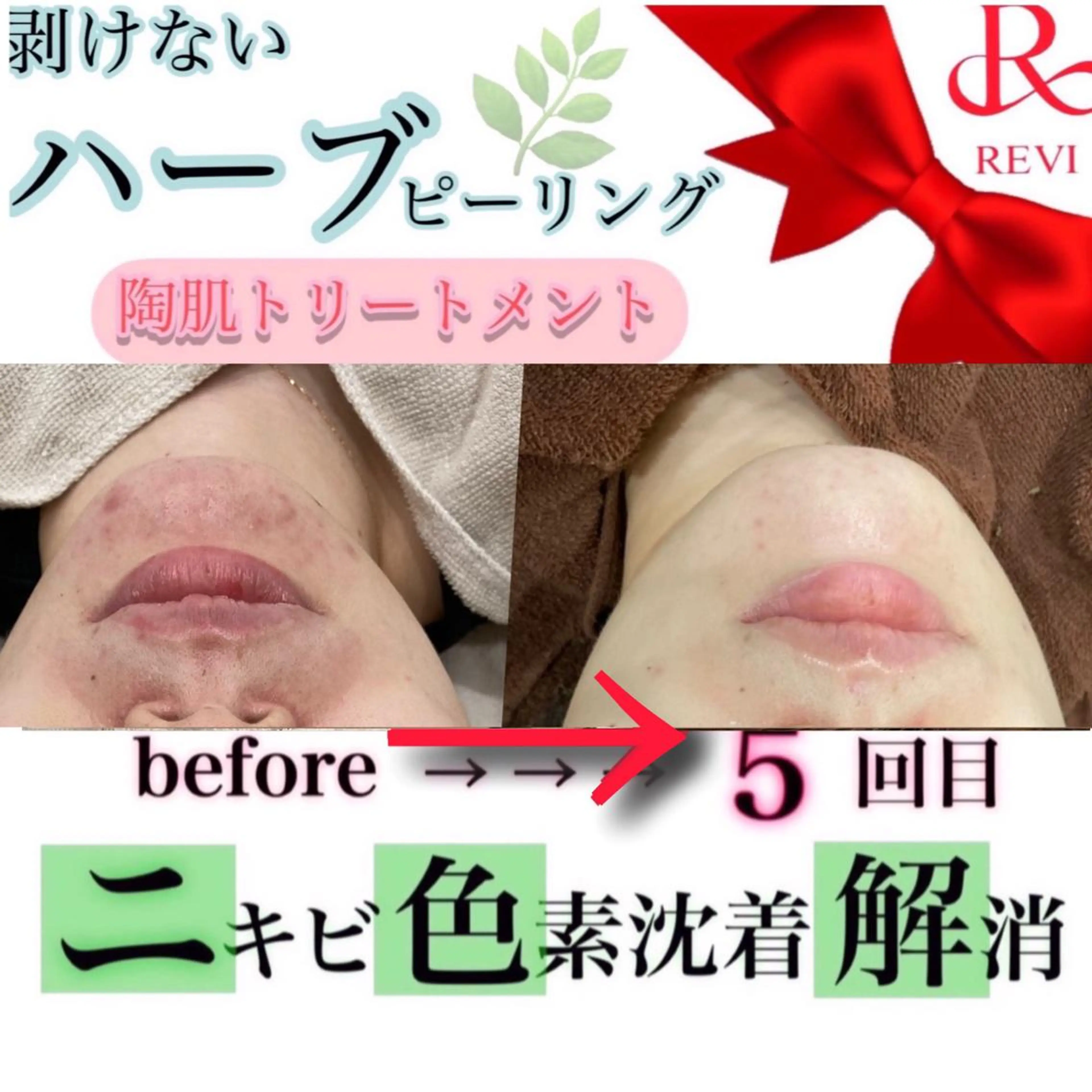 laluna saki...のエステ・リラクイメージ