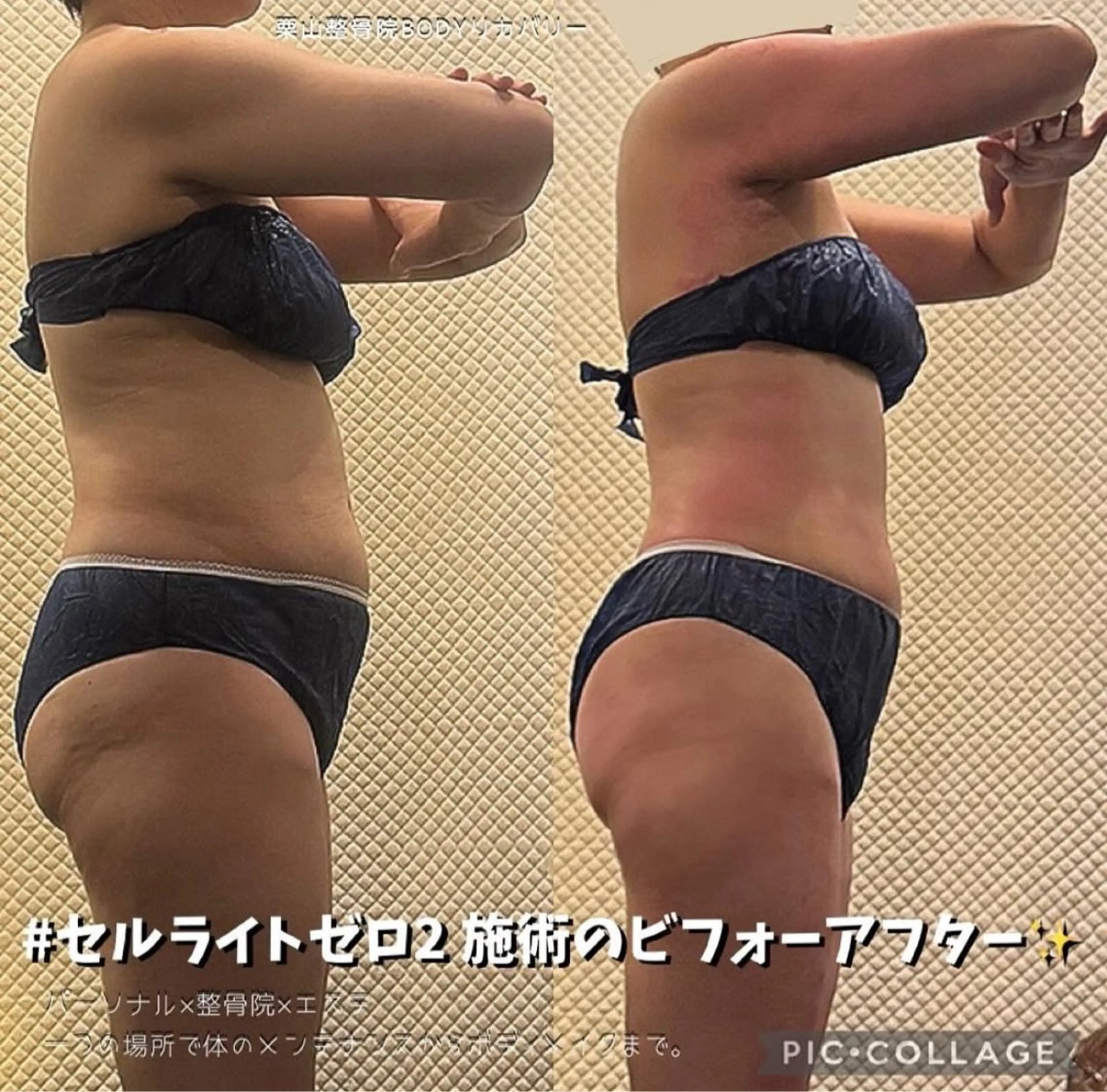 口コミ投稿で初回70%OFF◎セルライトゼロ2で一生物の健康と美を手に入れませんか？1番人気✨120分コース(メンズ可)の写真