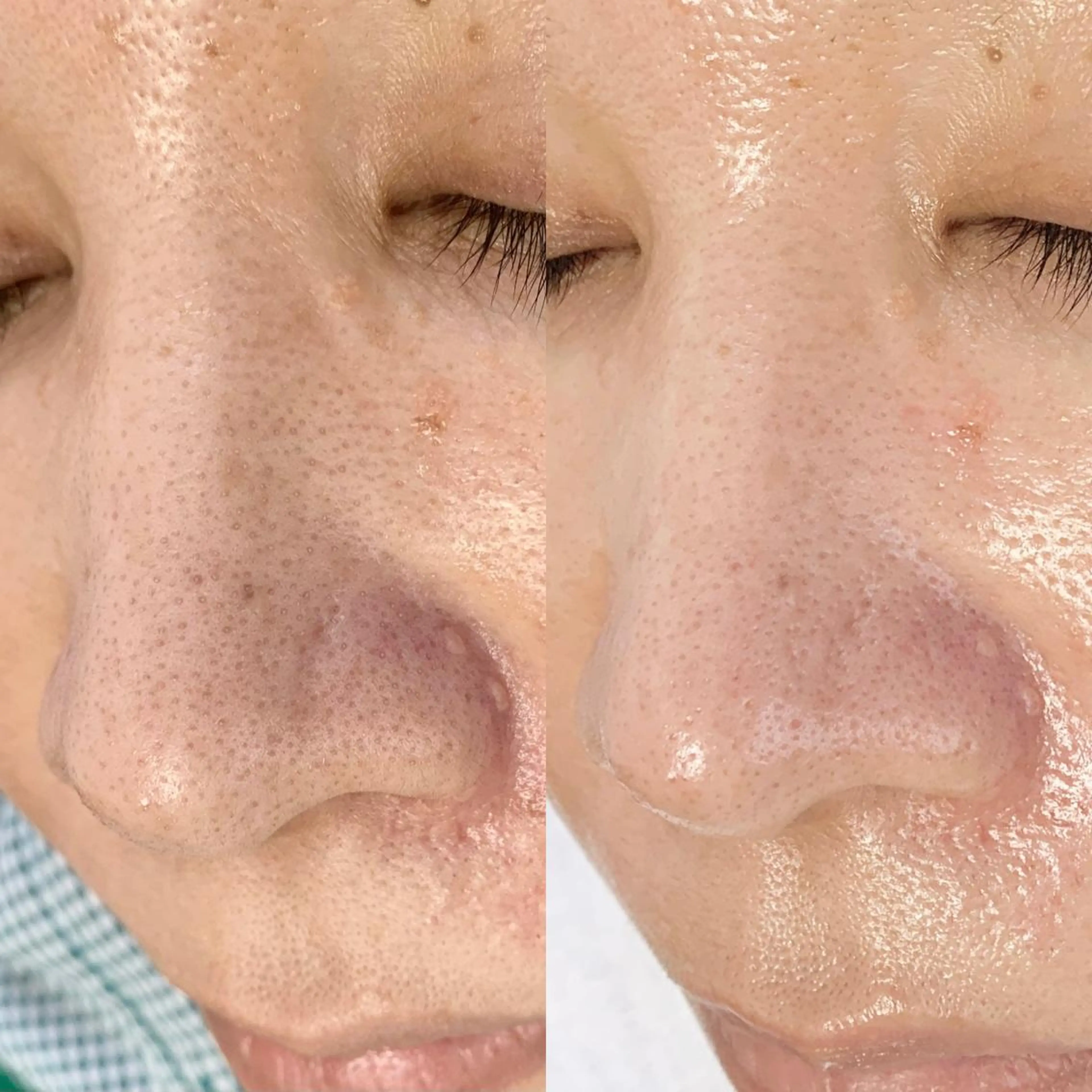 メンズ エステ salonLADYSTYLE所属・稲嶺 美華のエステ・リラクイメージ