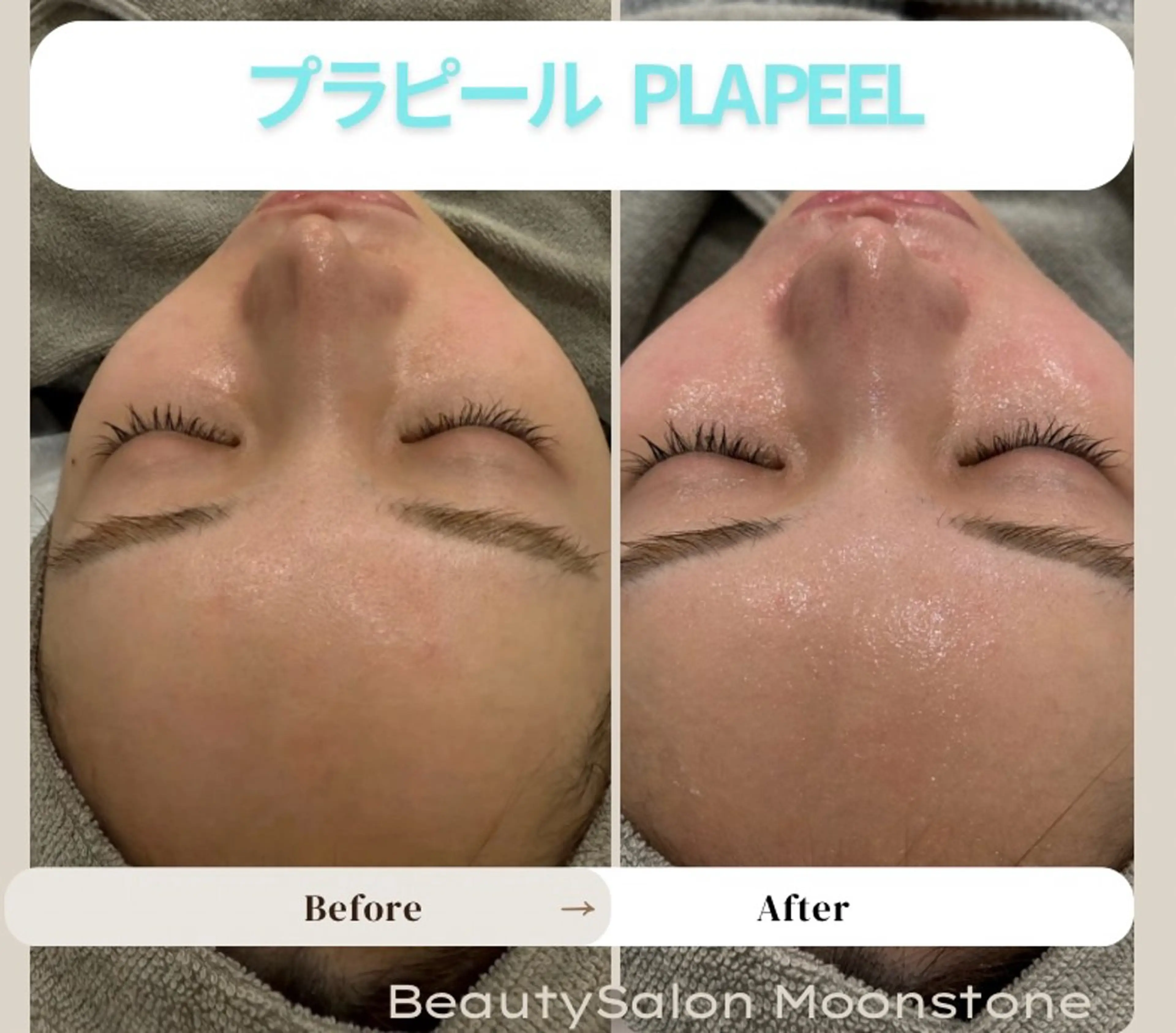 Beauty Salon Moonstone所属・Moonstone 男女•キッズ脱毛のエステ・リラクイメージ
