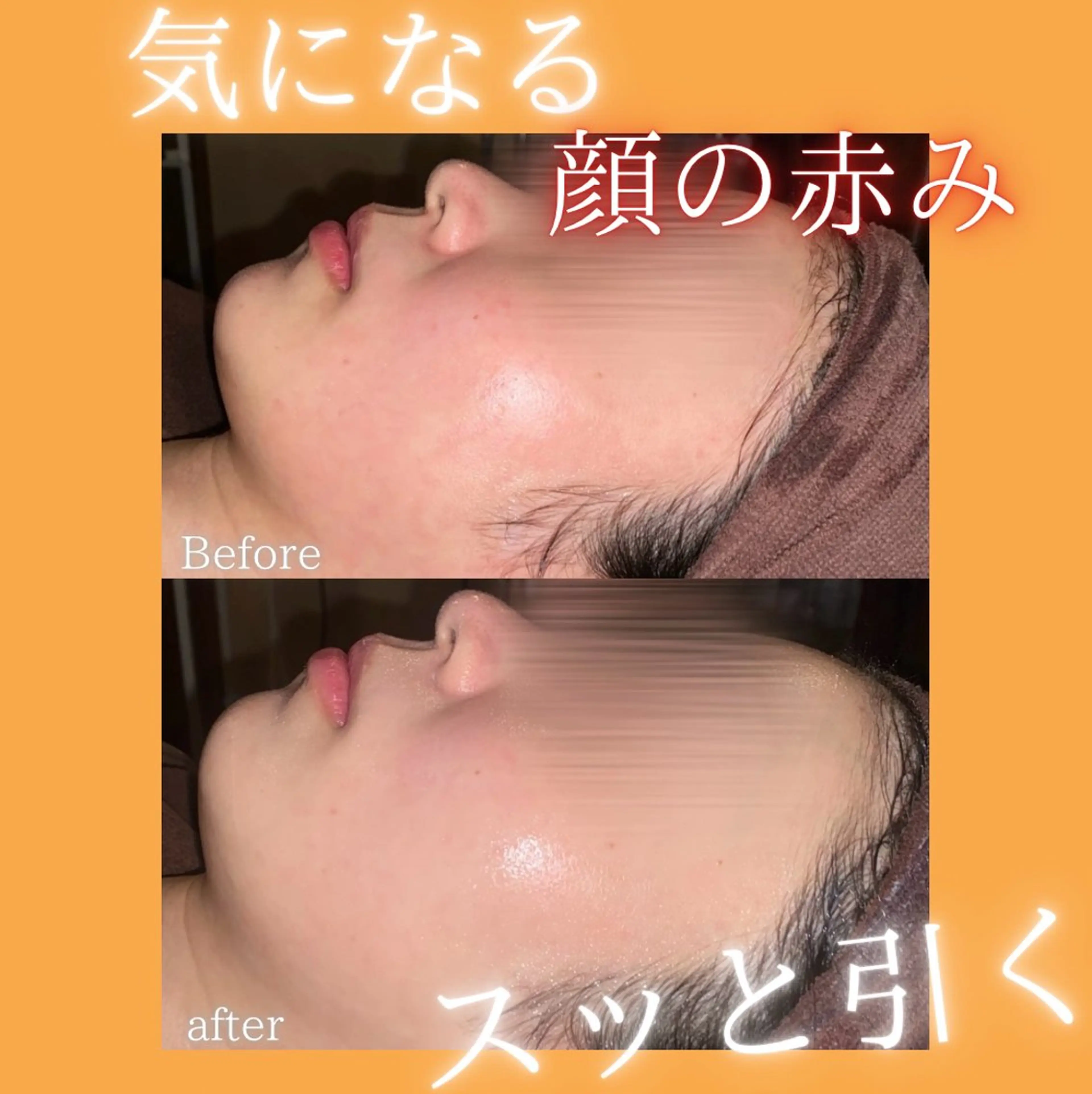エステ リラク 🫧ビュースタ 伊藤🫧のエステ・リラクイメージ