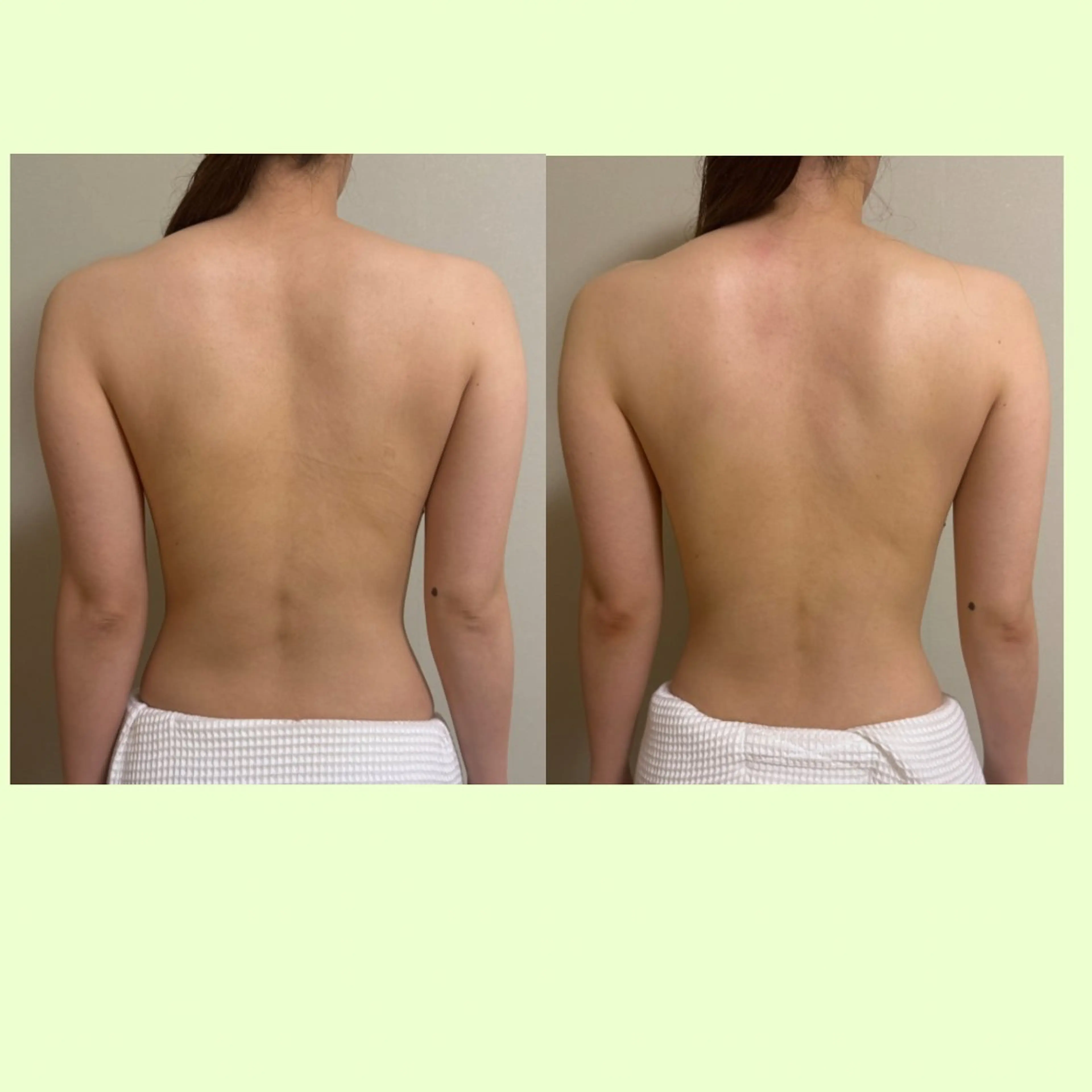 リラクゼーションスパ　ひのき所属・spaHINOKI 【女性専用】のエステ・リラクイメージ