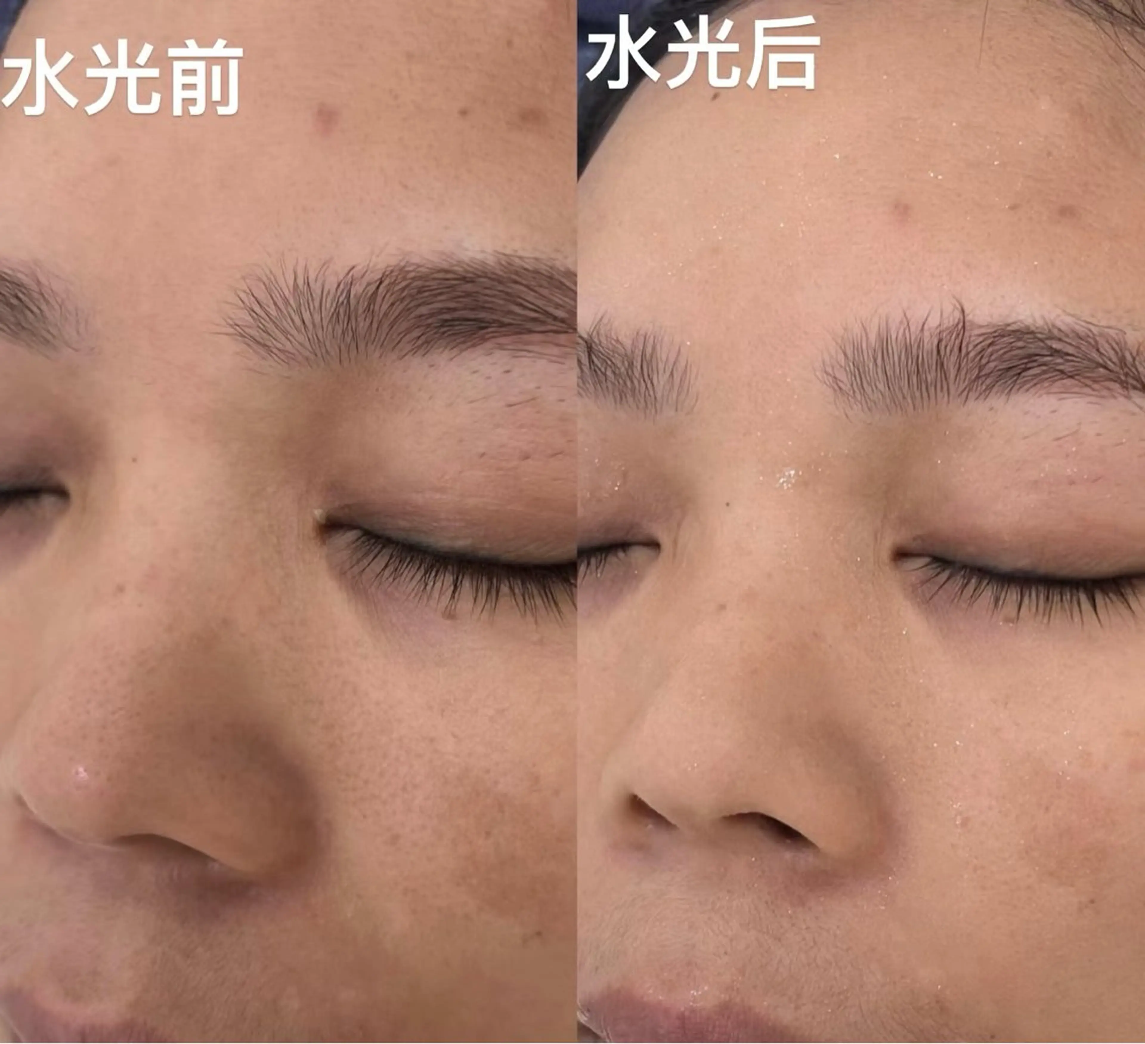 マツエク・マツパ エステ aliaハイフ&水光ジェットサロン所属・aliaハーブ水光店 エステティシャン募集のエステ・リラクイメージ