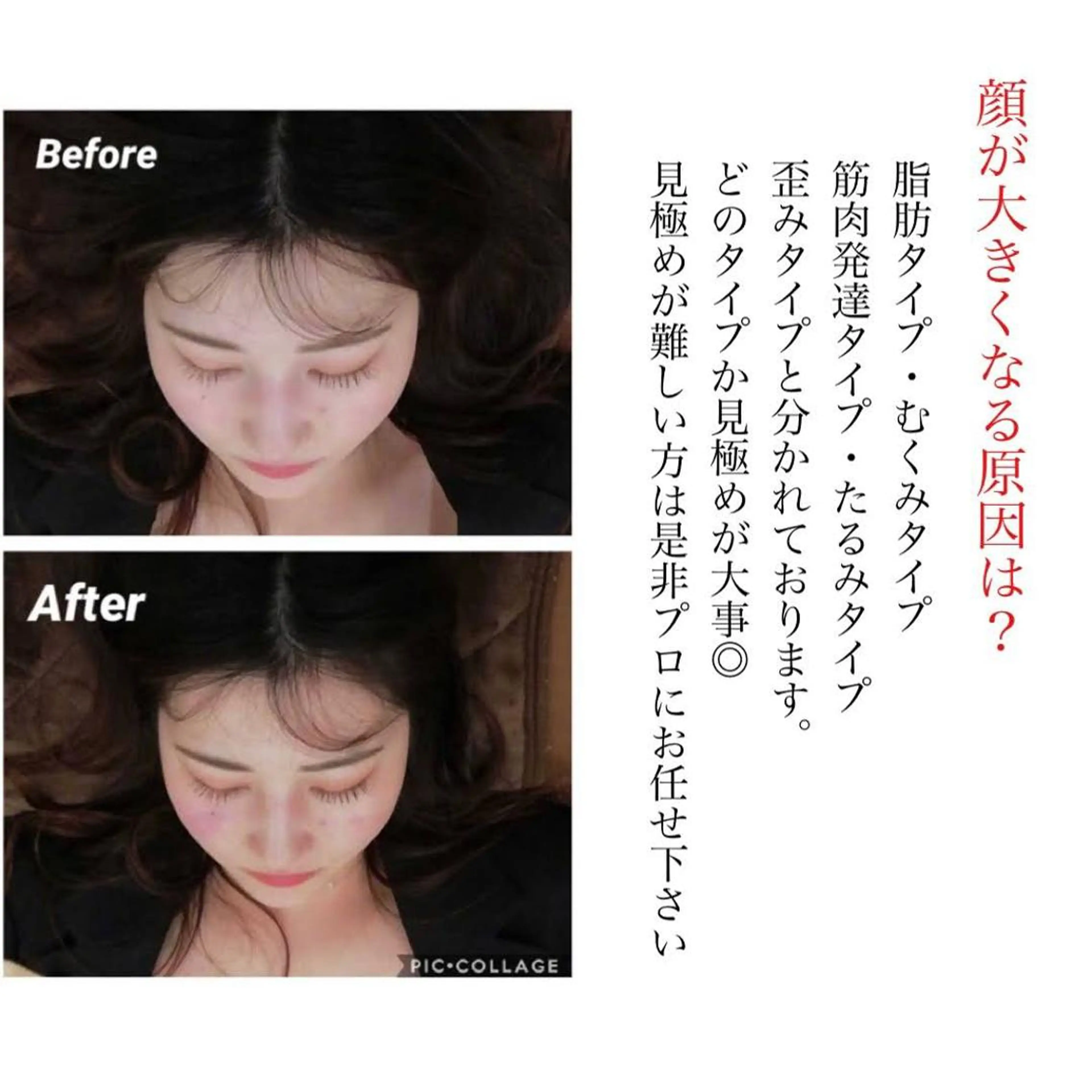 鍼灸整骨院悠所属・Taguchi yuuのエステ・リラクイメージ