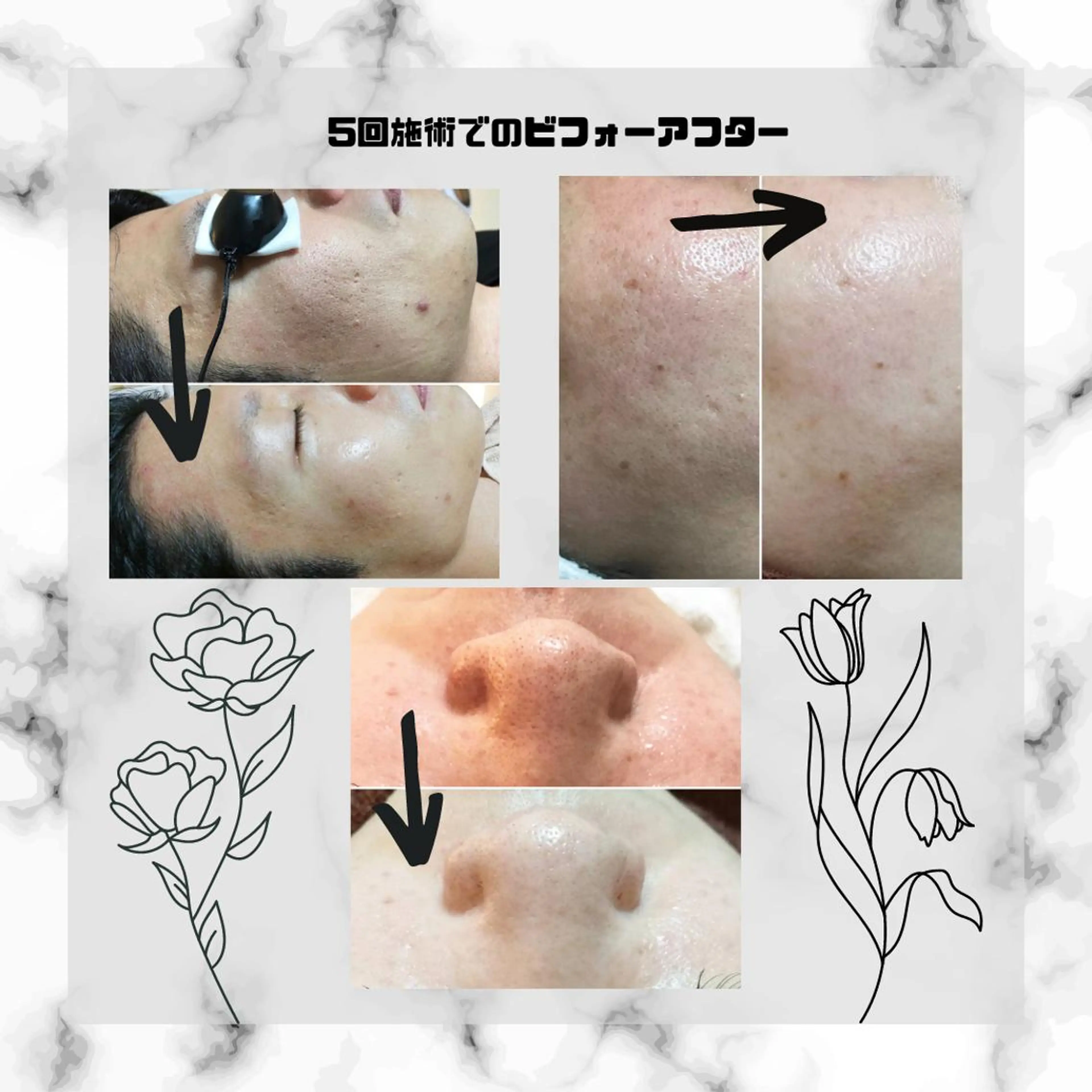 男女同額完全個室脱毛 LEPIA内田のエステ・リラクイメージ