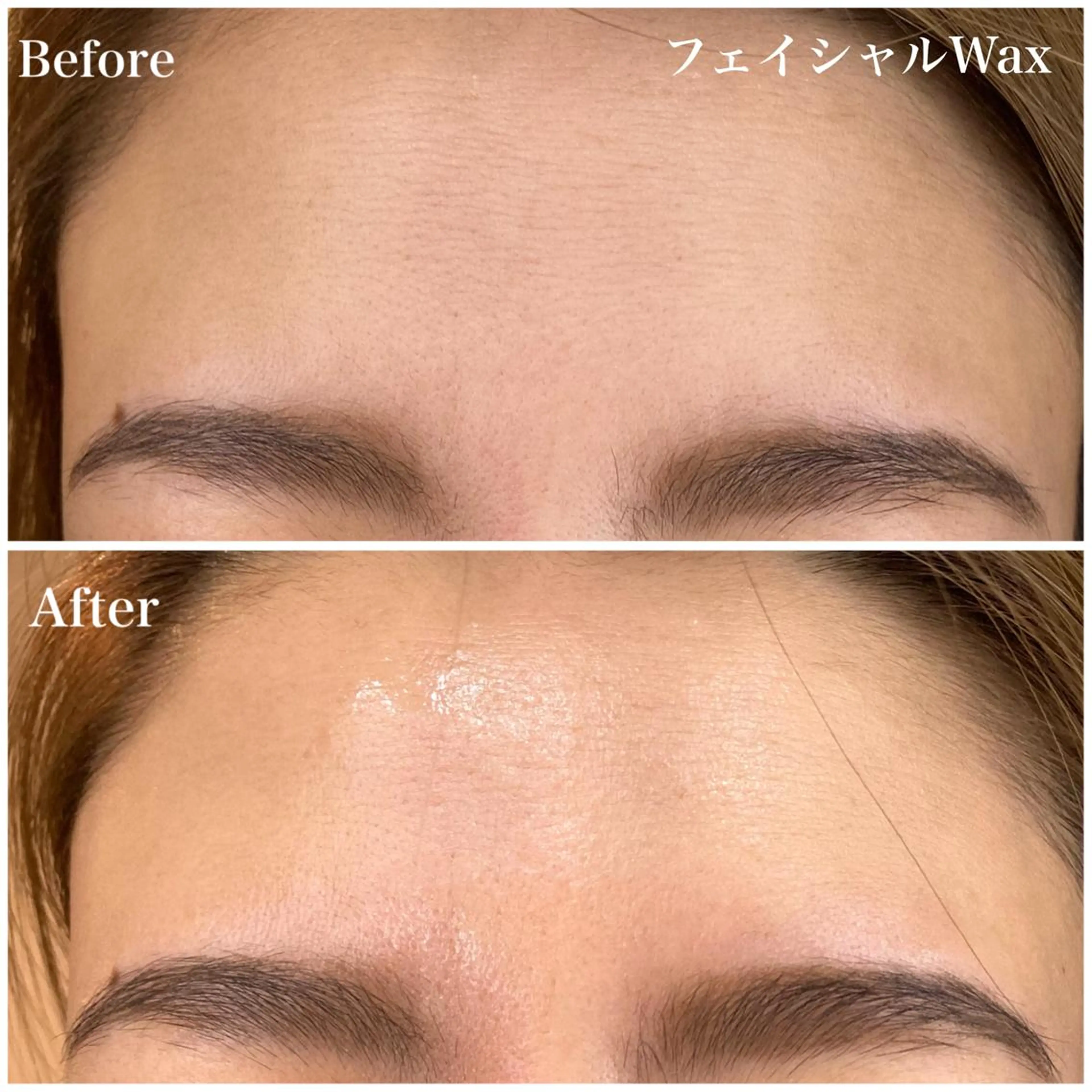 脱毛 B&H所属・頭痛•肩こり専門/ 眉サロンB&H心斎橋のエステ・リラクイメージ