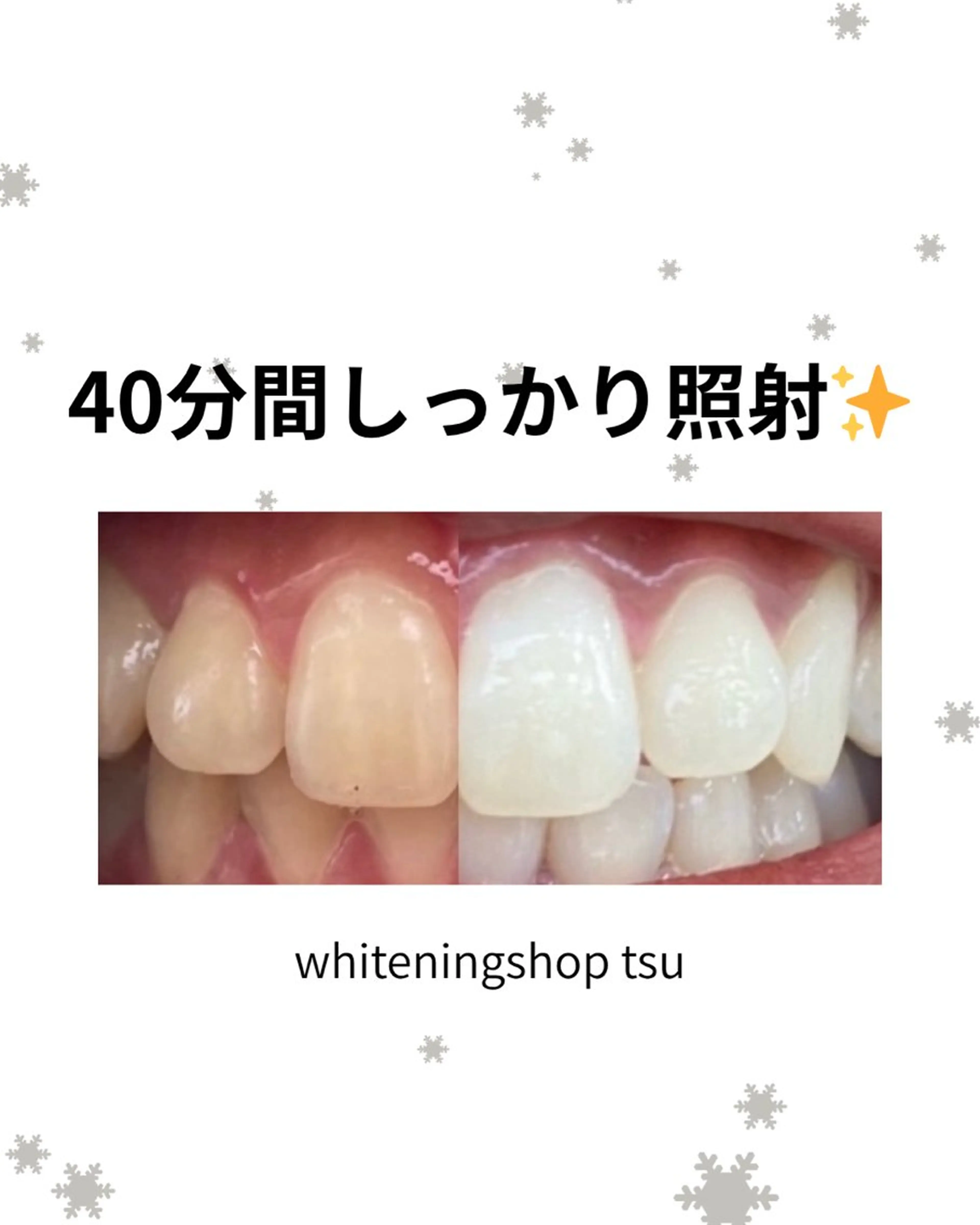 その他 ホワイトニングショップ津店所属・ホワイトニング ショップ津店のその他イメージ