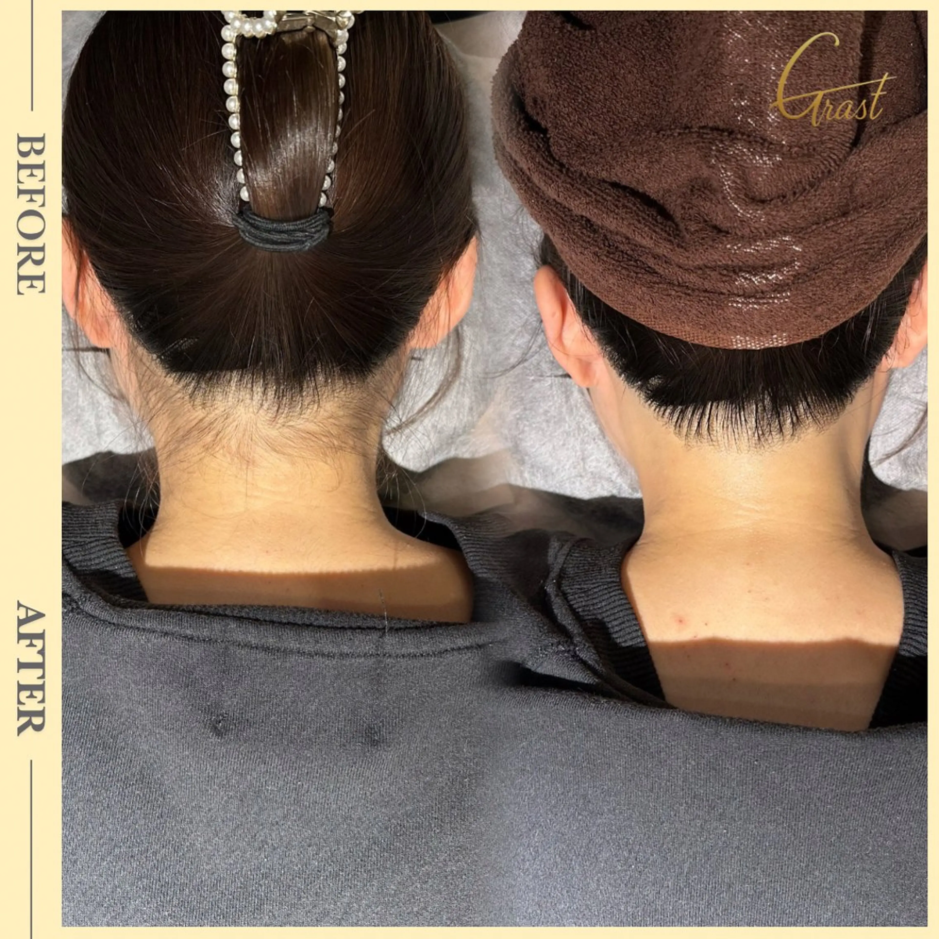 脱毛 プライベートサロン Grast🪴アイカのエステ・リラクイメージ