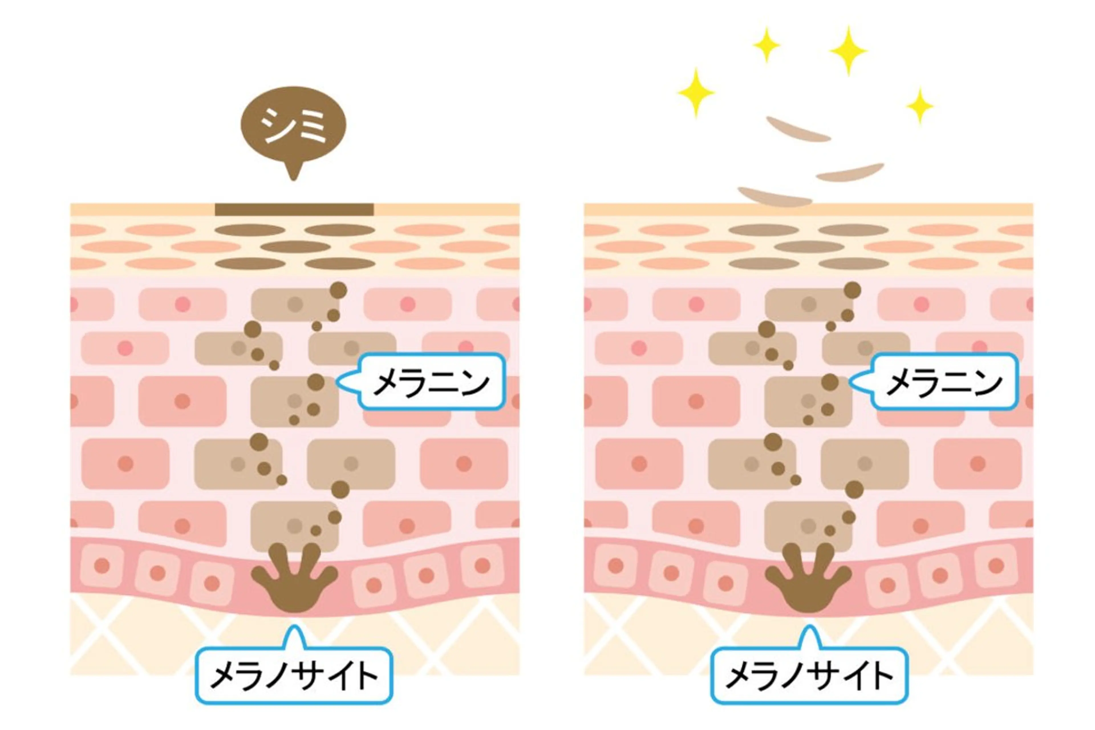 エステ SELF  BEAUTY gracia浦添店所属・gracia 浦添店のその他イメージ