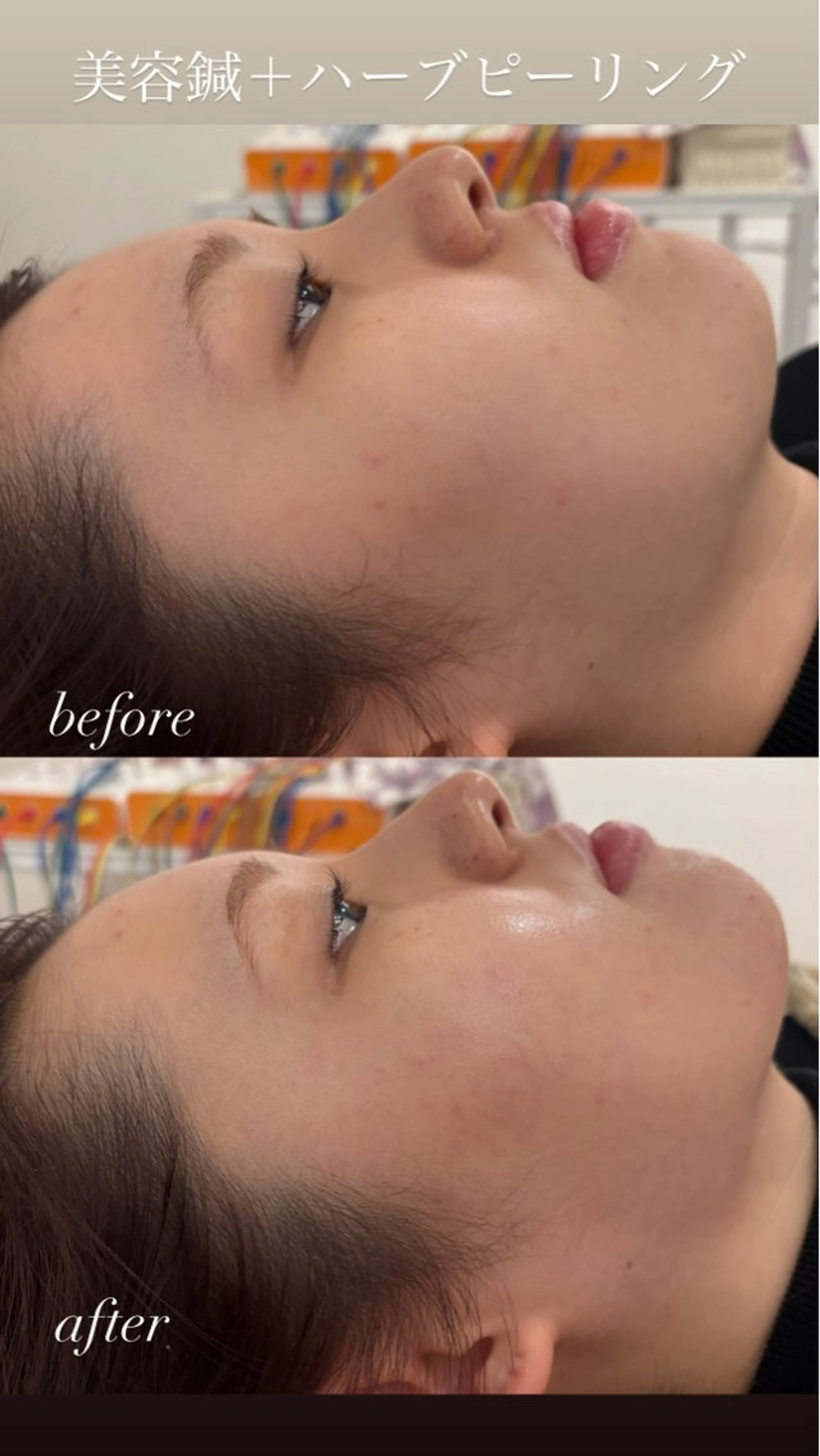 エステ リラク 美容鍼灸サロン mahoroba院長のエステ・リラクイメージ