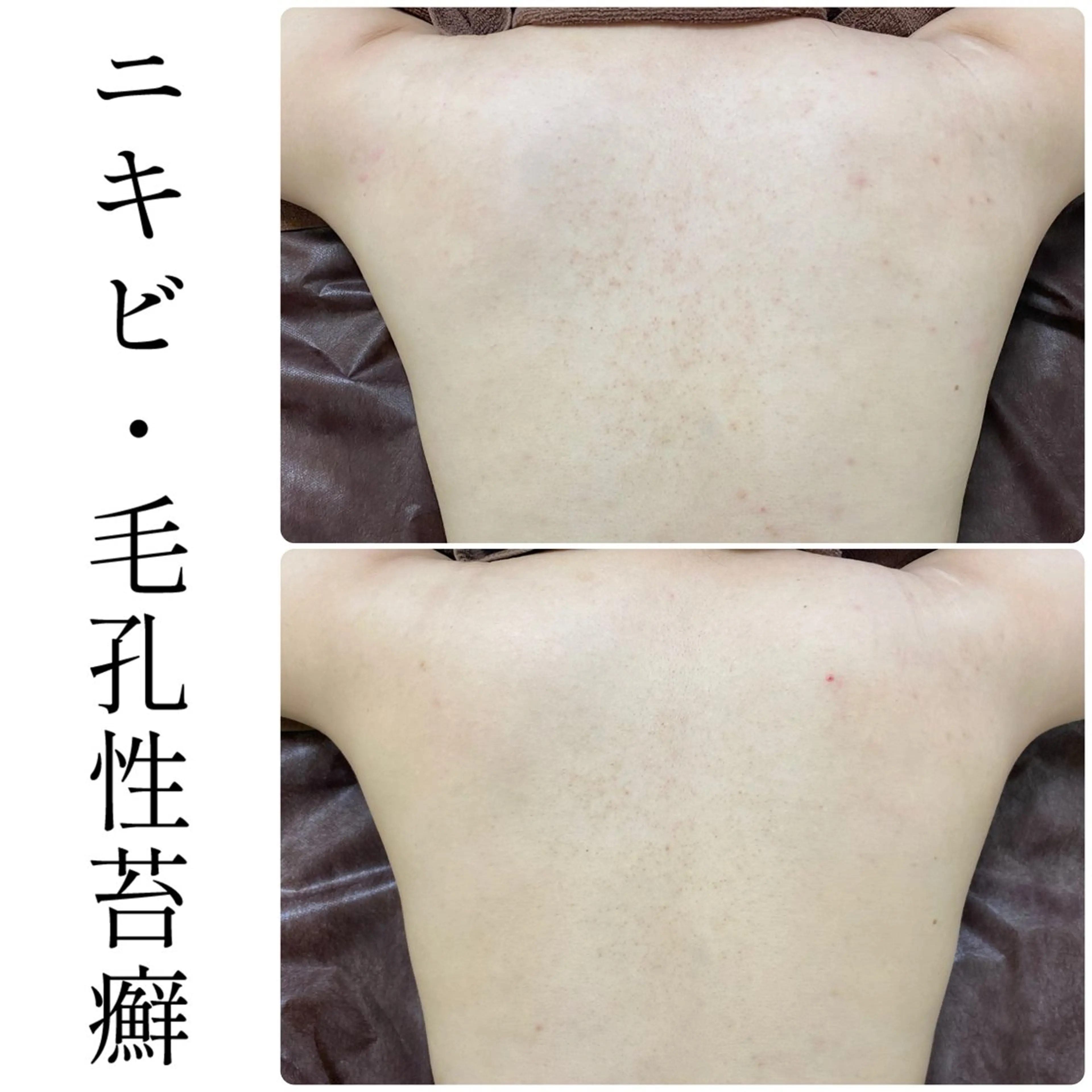 エステ ハーブピーリング専門 BIOEL横浜のエステ・リラクイメージ