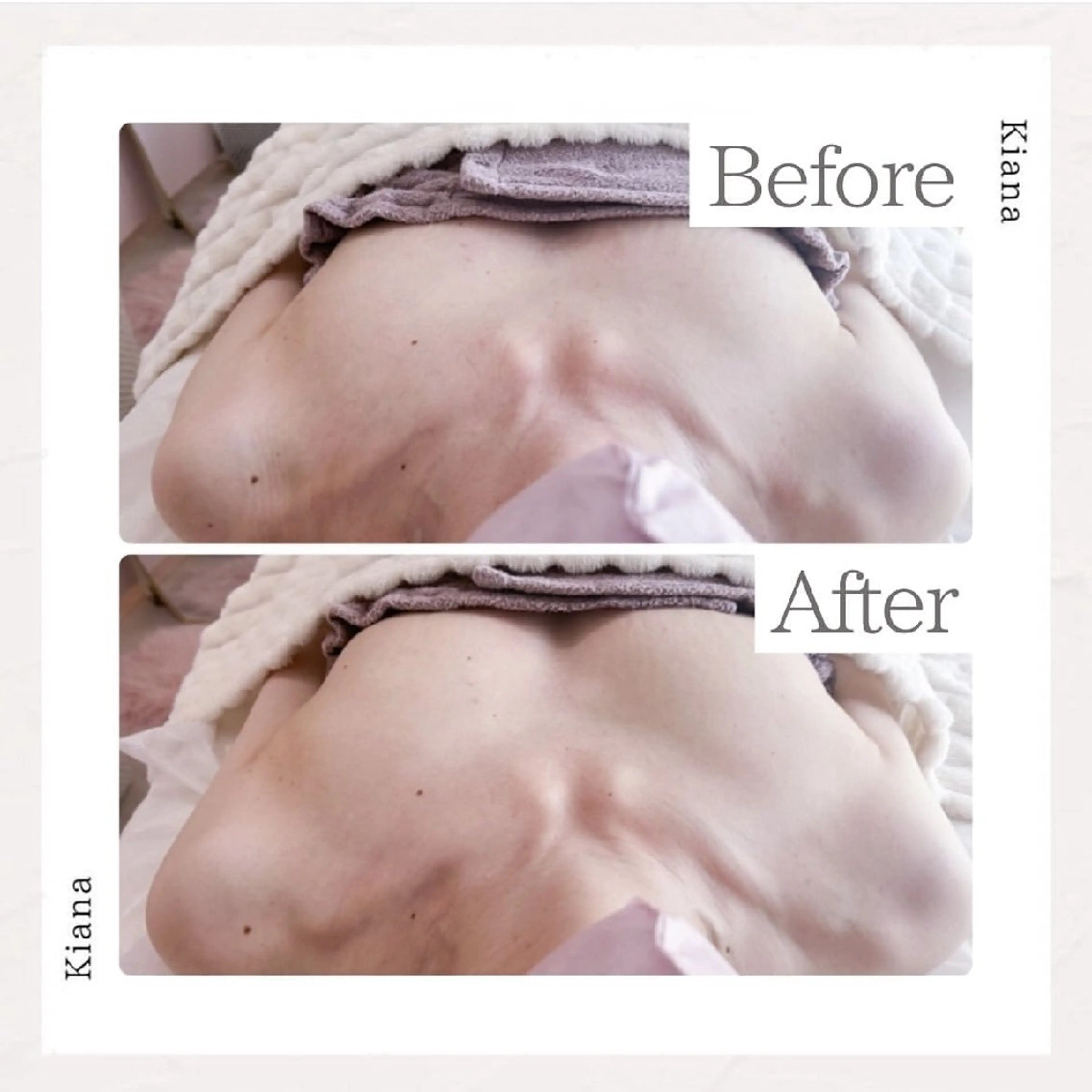 エステ リラク 【バスト専門店 】 Kiana のエステ・リラクイメージ