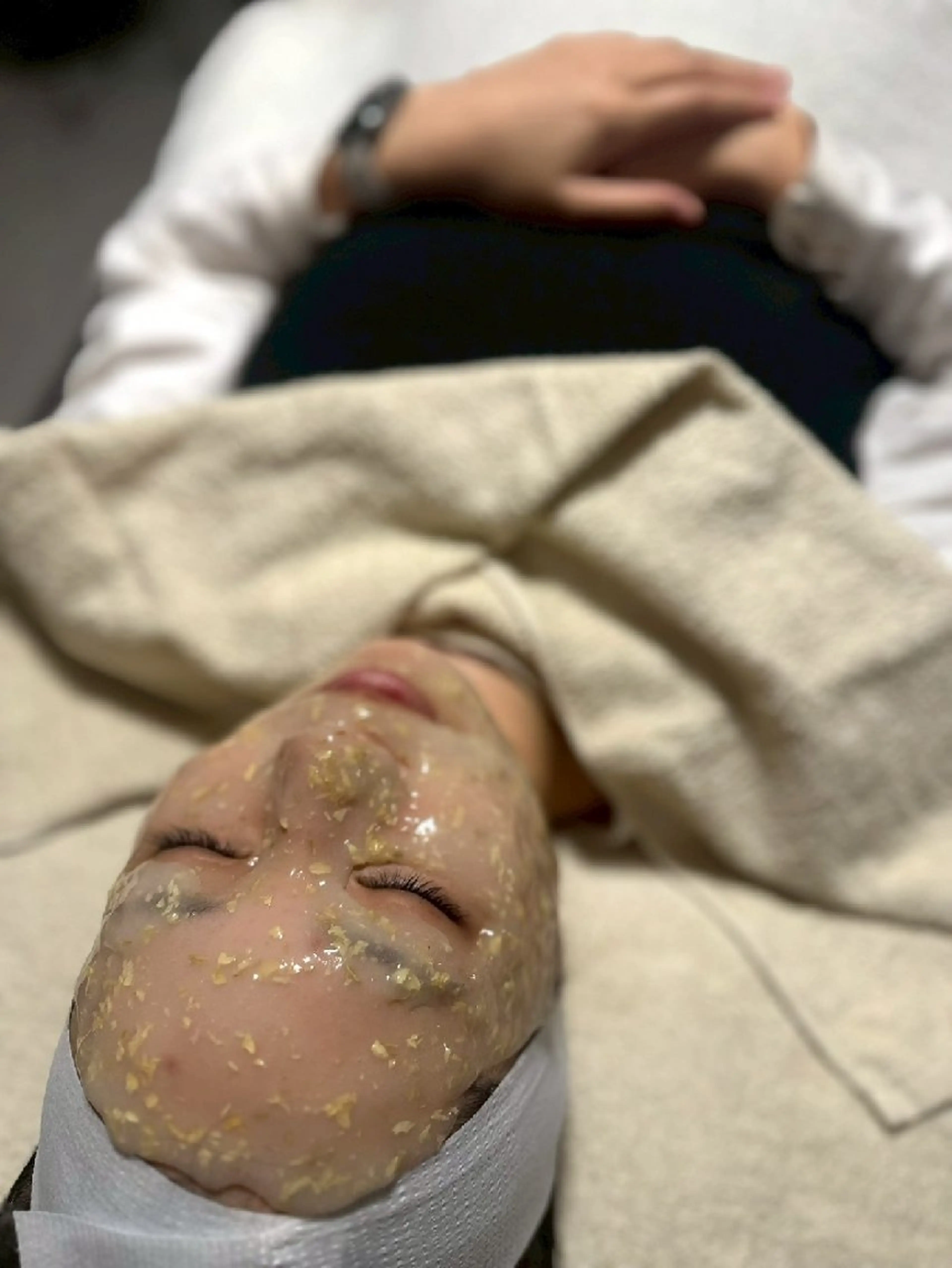 艶肌爆誕！ラミネーションピール（肌悩み別選べるハイドロジェリーマスク付）の写真