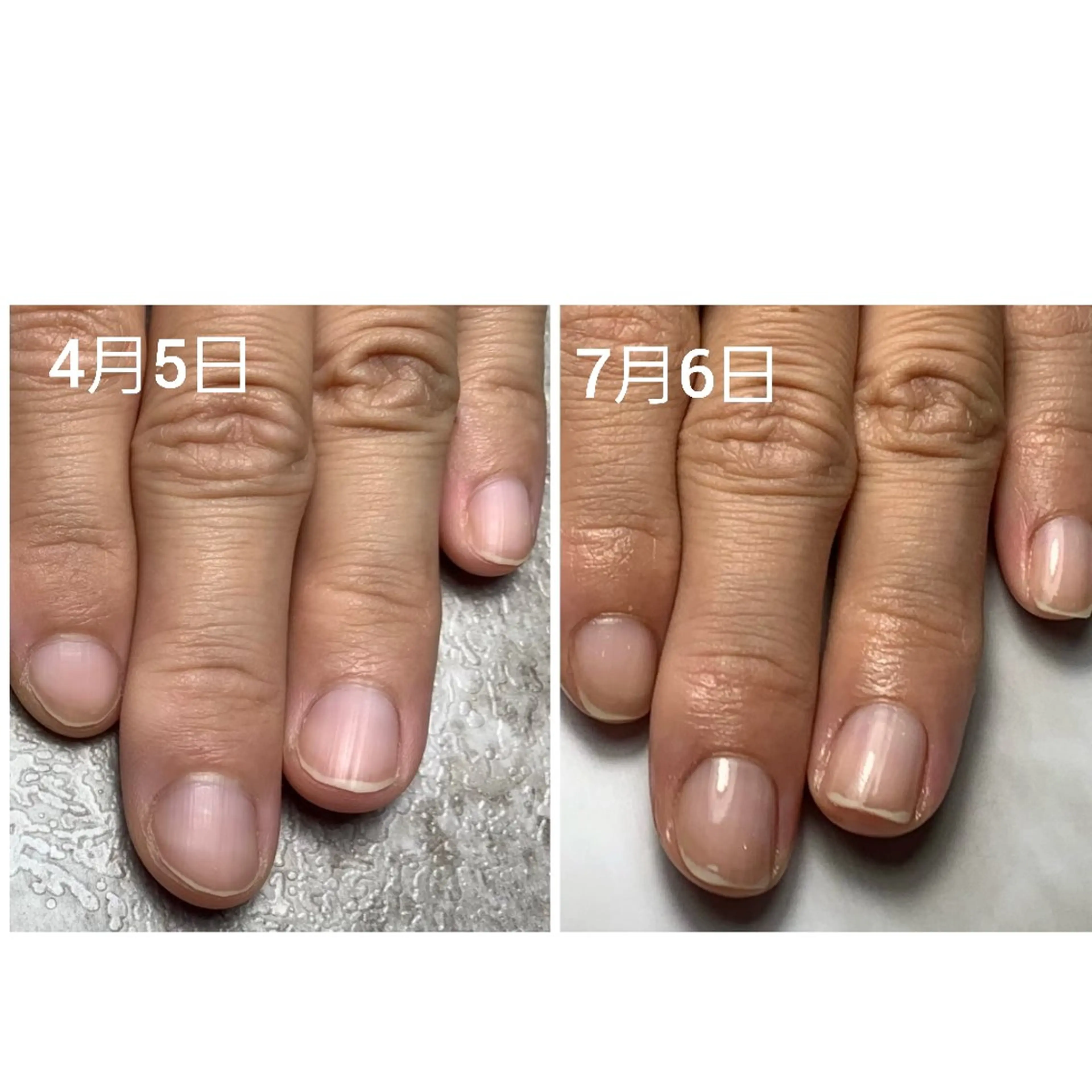 ネイル ハンドケア AKT NAIL所属・AKT Beauty ドライヘッドスパのネイルデザイン