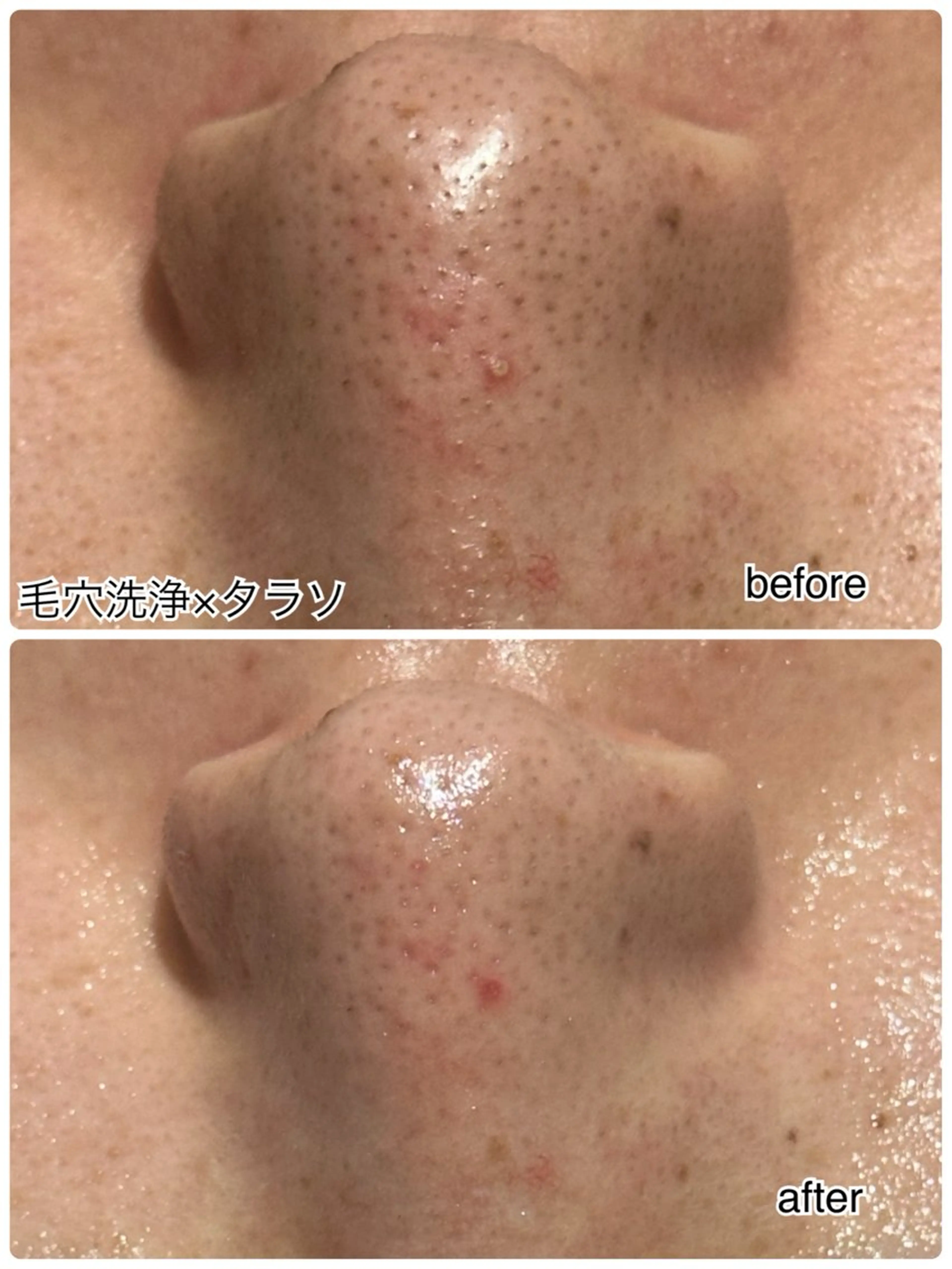 その他 ENCHANT 脱毛.小顔.毛穴のエステ・リラクイメージ