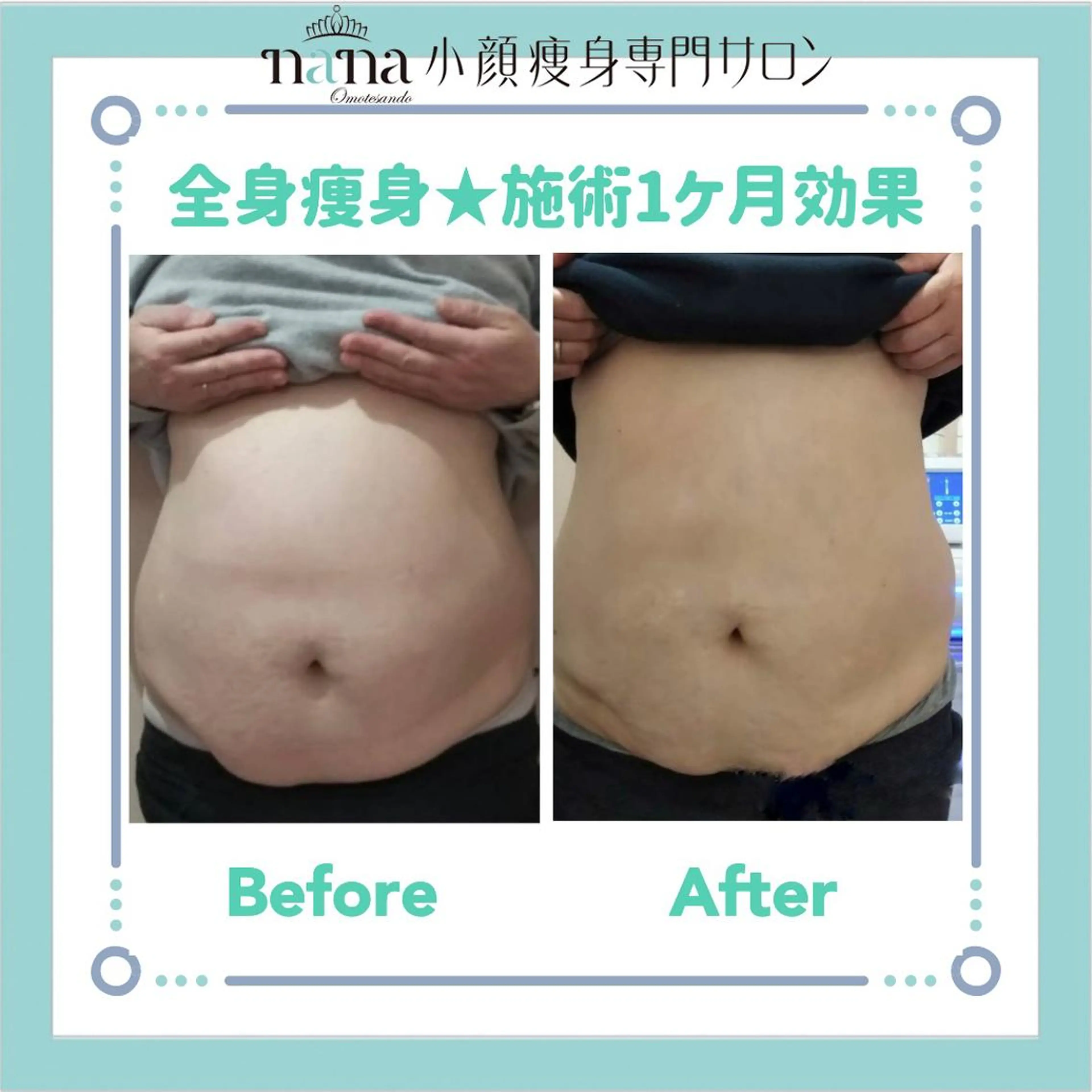 小顔痩身インディバ Nana表参道のエステ・リラクイメージ