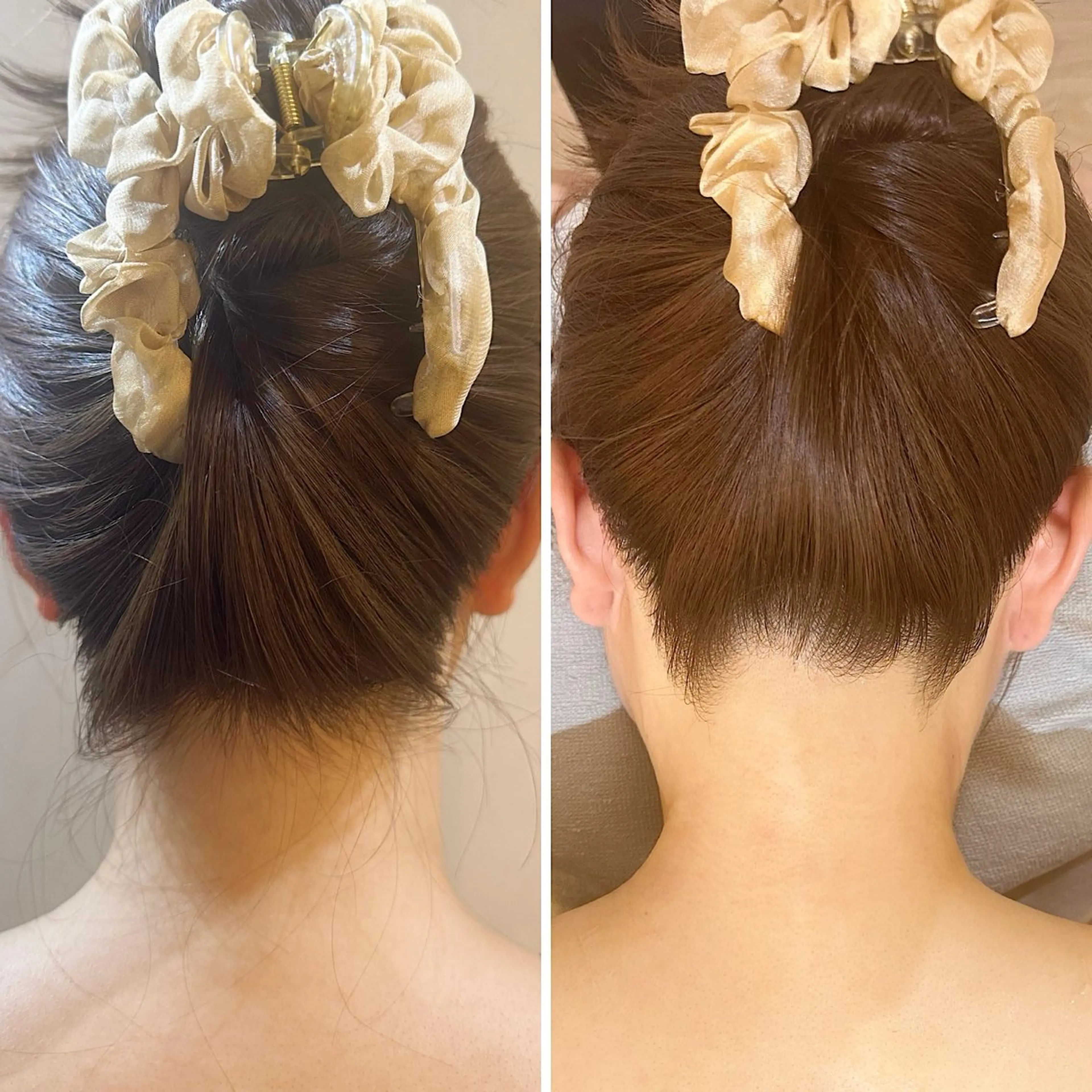 脱毛 うなじ脱毛/美肌脱毛 LABELのエステ・リラクイメージ