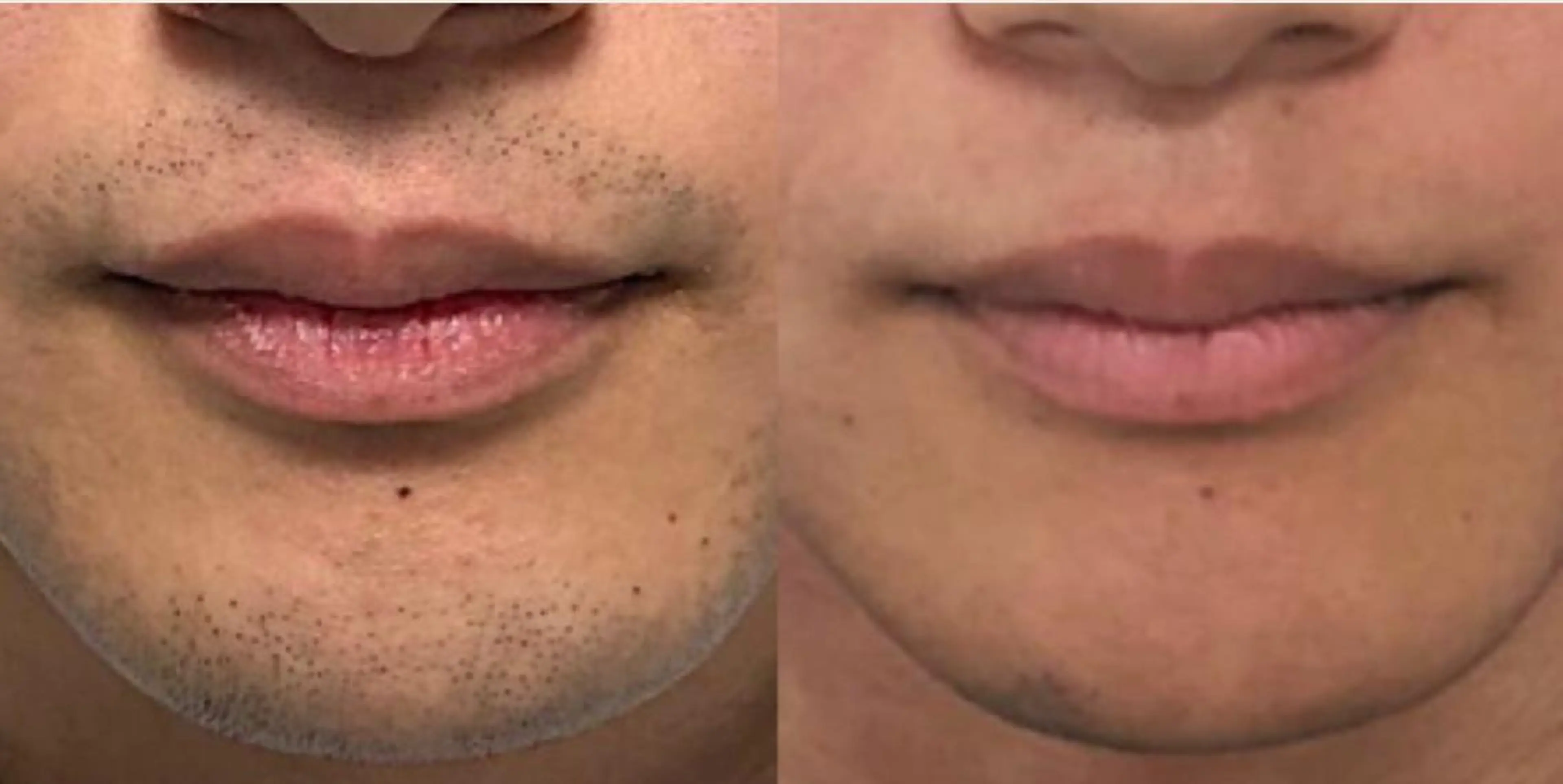 メンズ プライベートサロンBRAG所属・プライベートサロン BRAG🏠男女OKのエステ・リラクイメージ