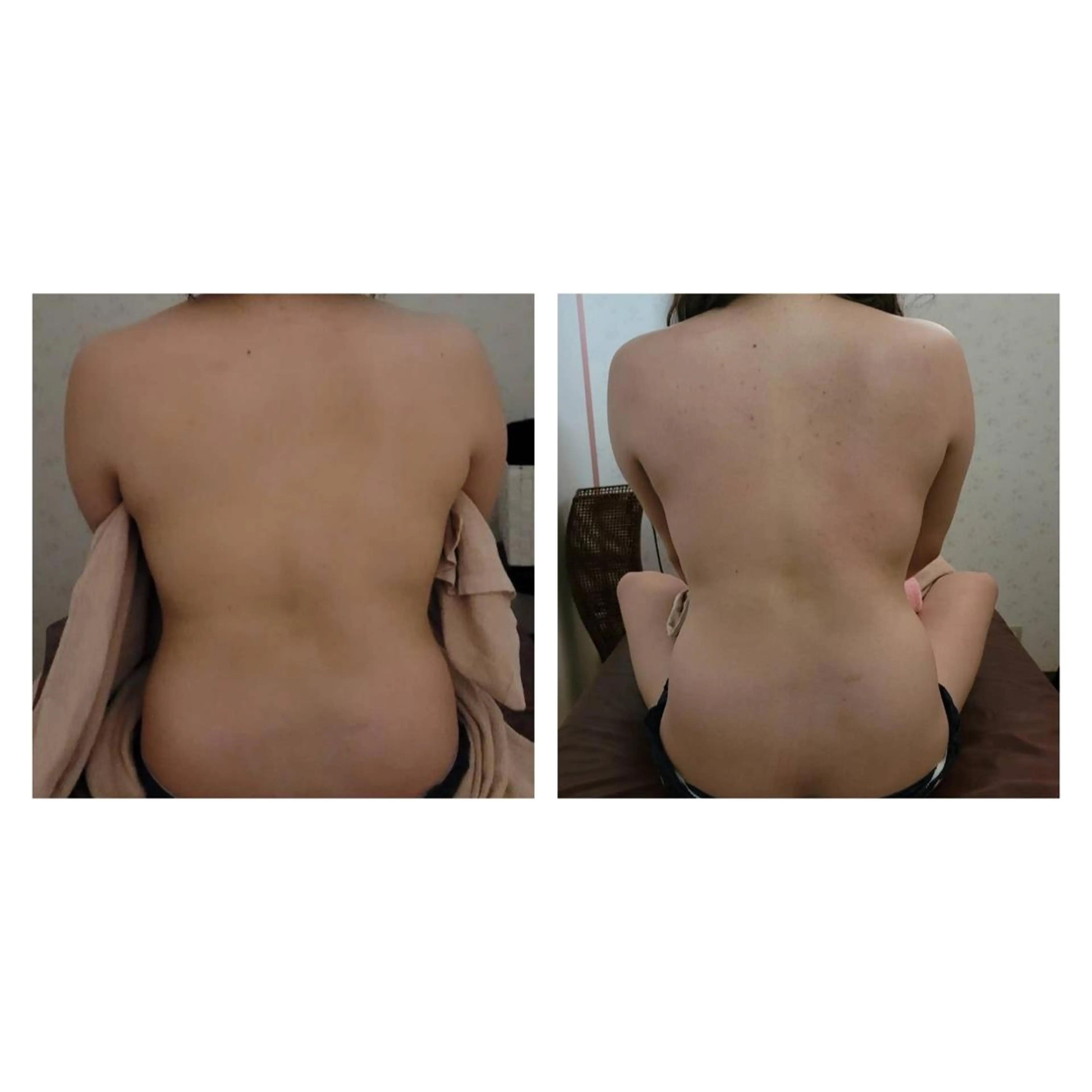 【ハイパーナイフ痩身&小顔コルギ&ハーブピーリング】K-Beauty　東新宿所属・kーbeauty痩身 フェイシャルのエステ・リラクイメージ