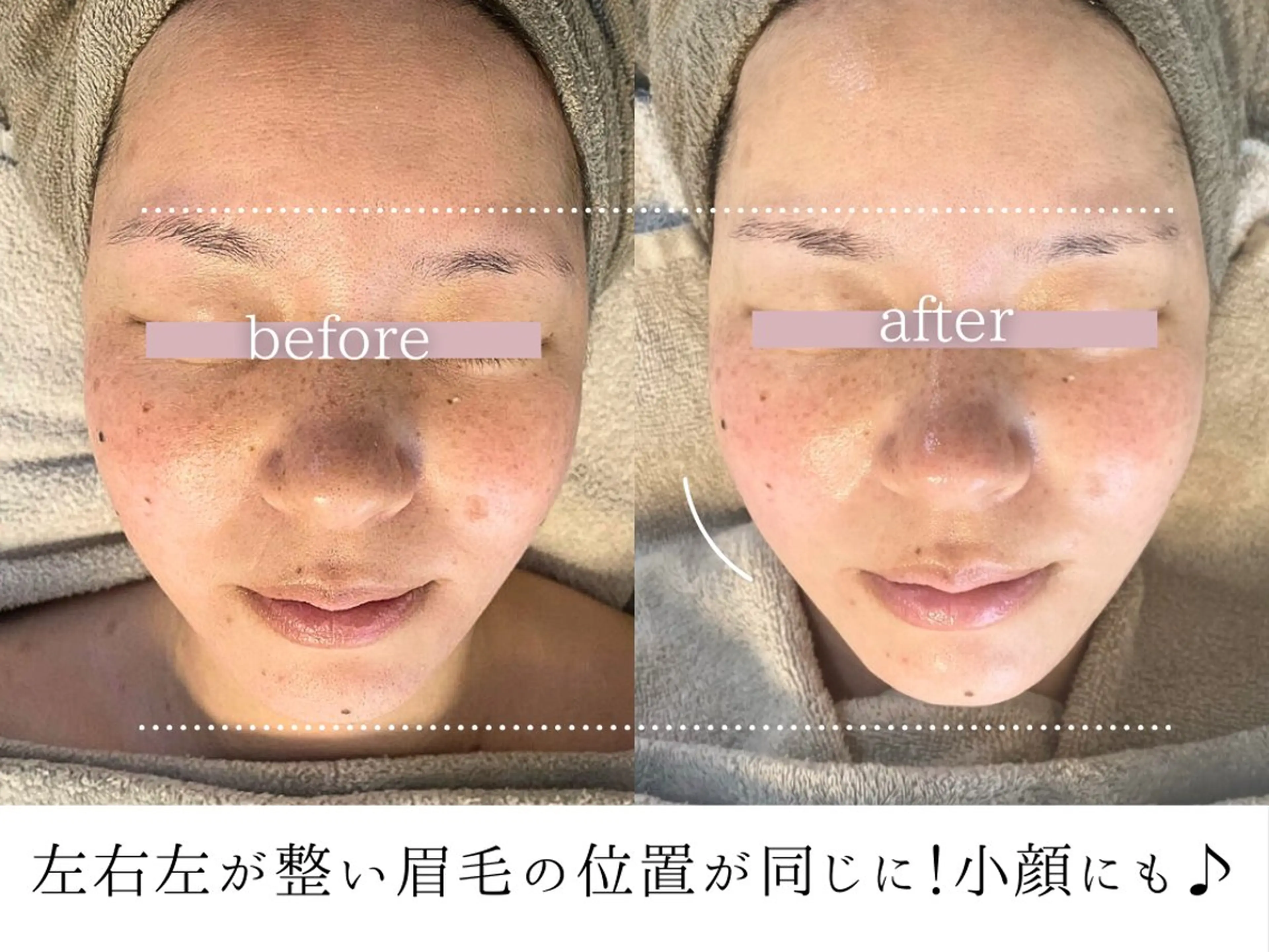 頭蓋骨小顔コルギPerm所属・頭蓋骨小顔コルギ Permのその他イメージ