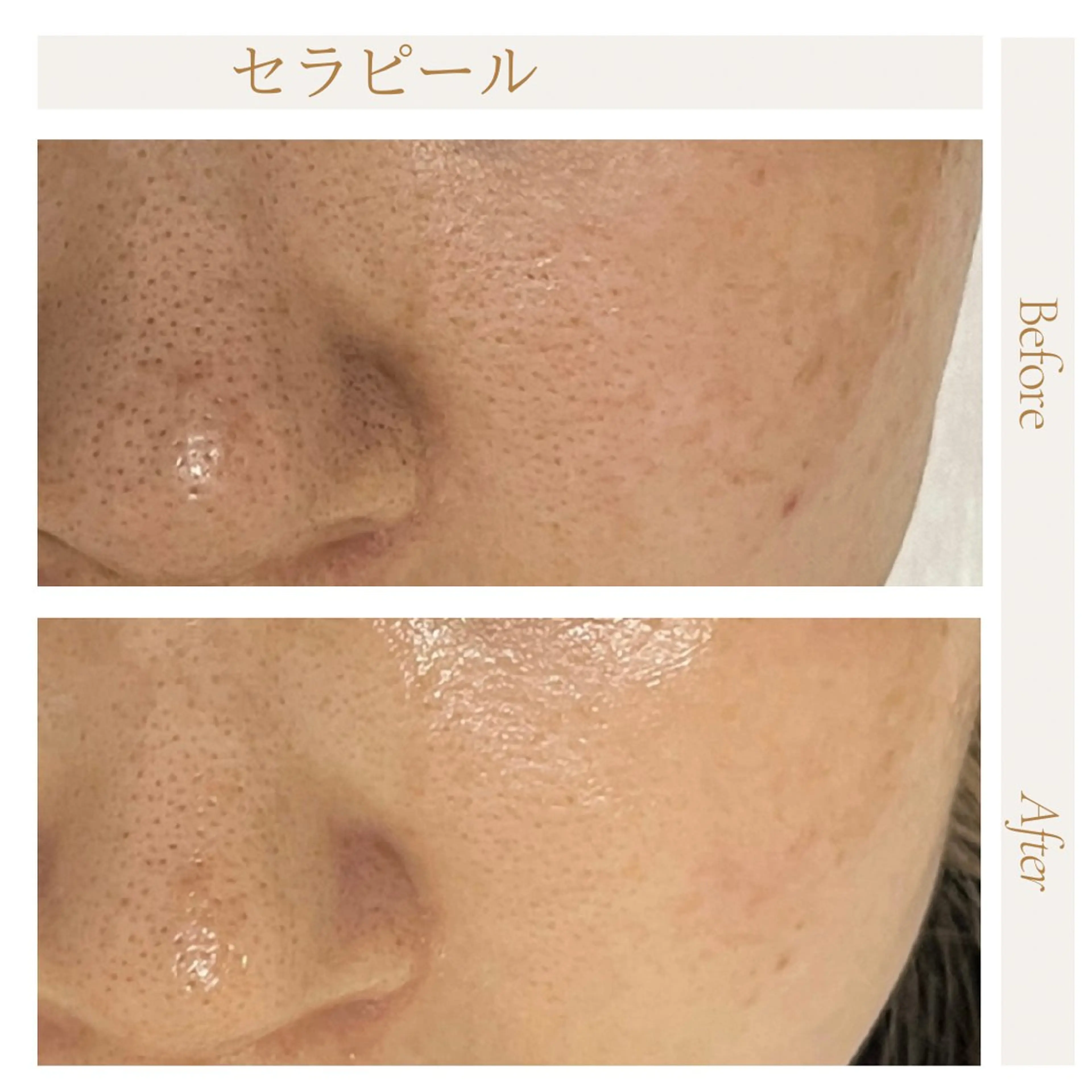 privatesalon icca所属・mana iccaのエステ・リラクイメージ