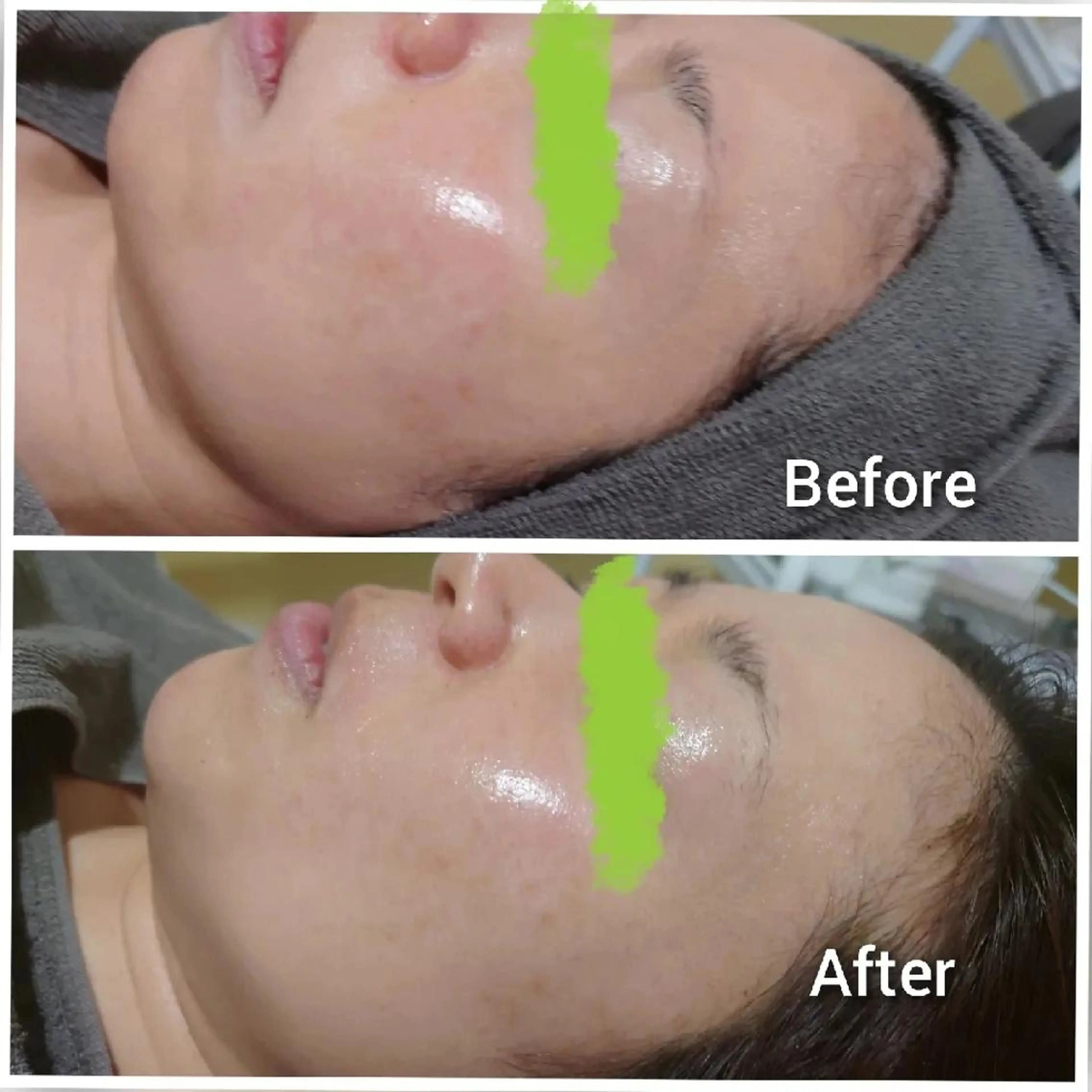 エステ Beauty Salon Luana所属・Luanaまつパ脱毛 ハーブピーリング眉毛のマツエク・マツパデザイン