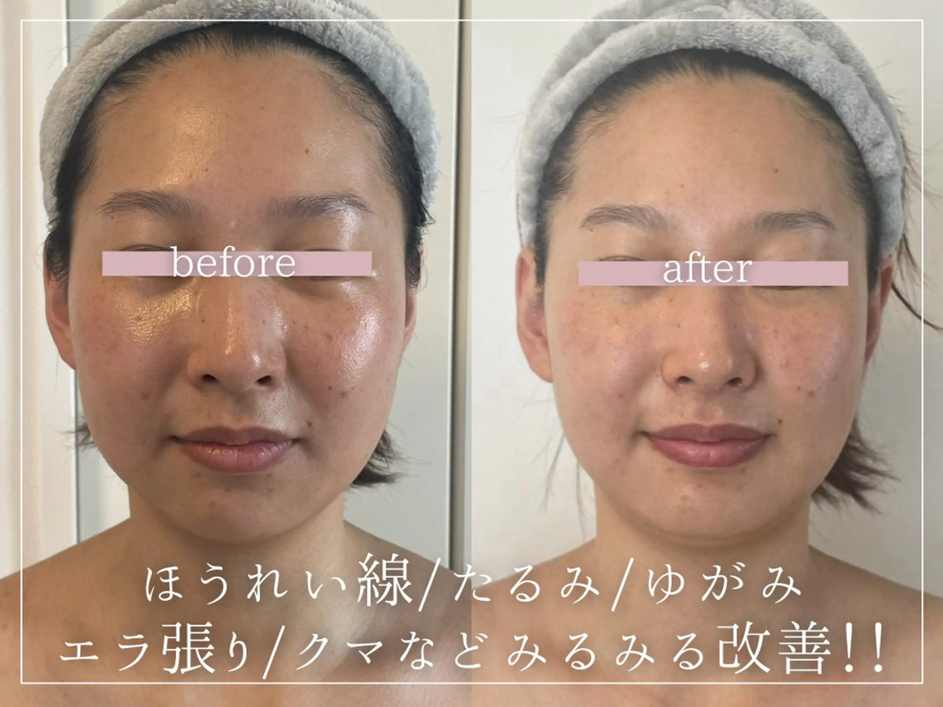 頭蓋骨小顔コルギPerm所属・頭蓋骨小顔コルギ Permのその他イメージ