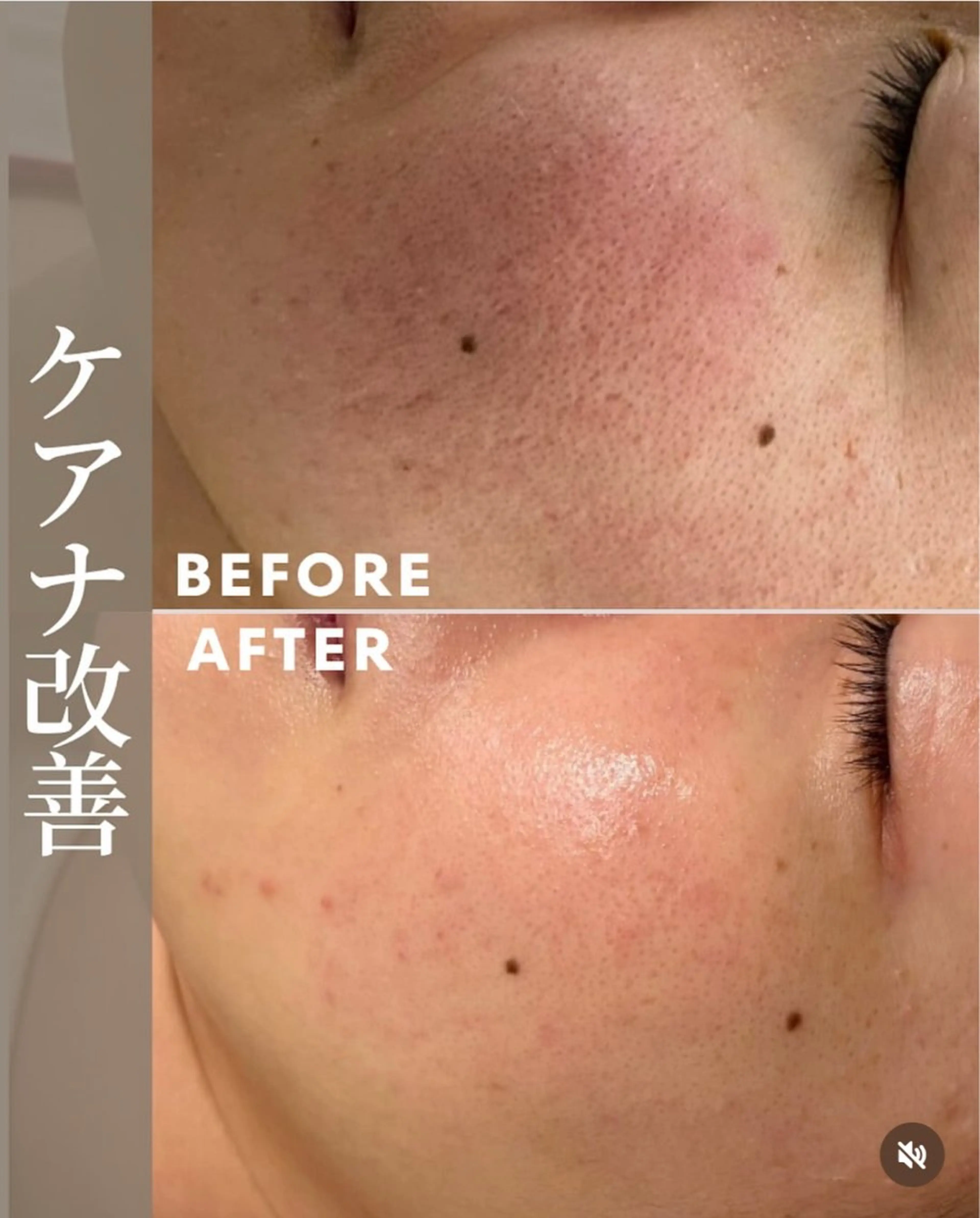 エステ 肌育成サロン ♡ 村田理紗のエステ・リラクイメージ