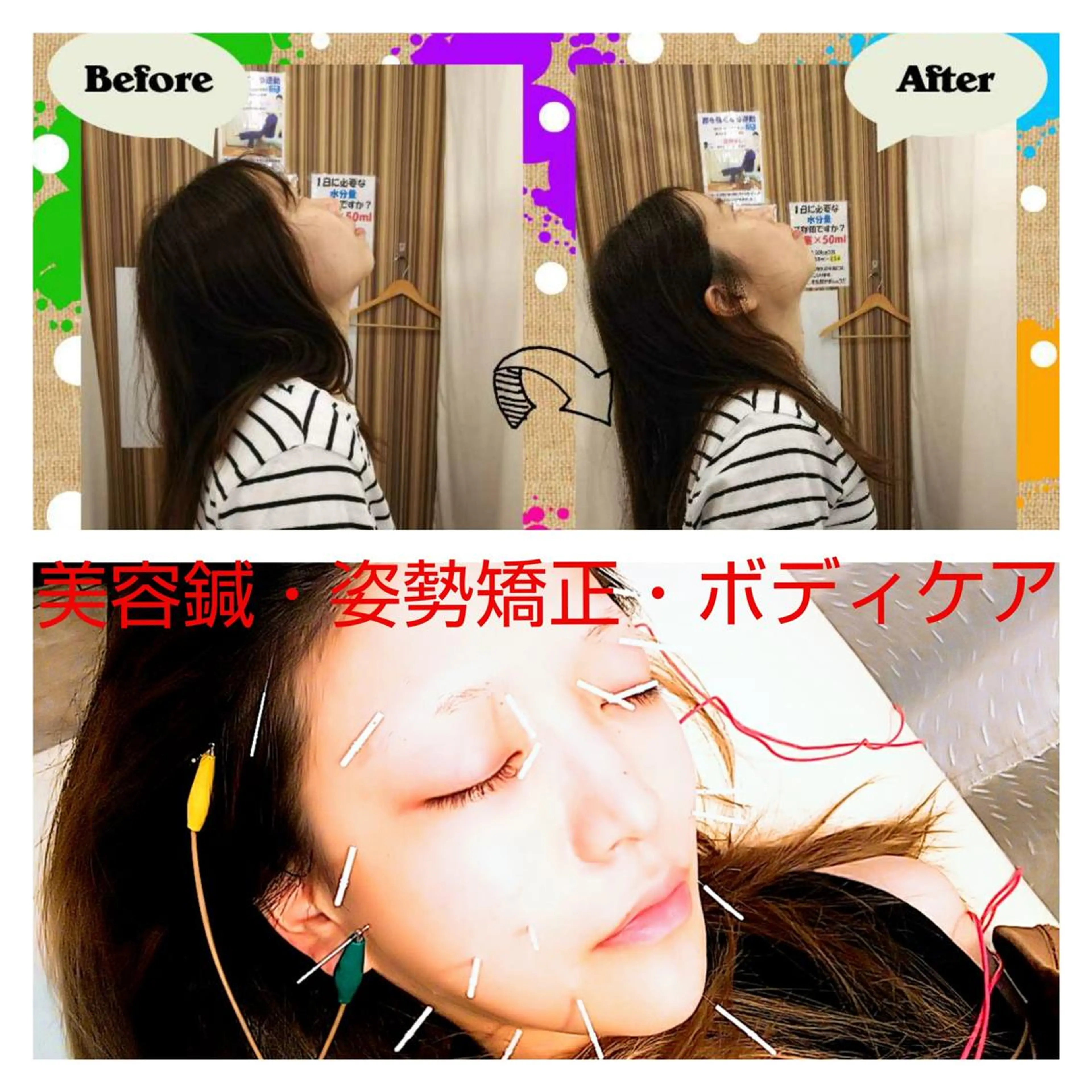 むくみたるみ専門☆ 美容鍼・小顔矯正のエステ・リラクイメージ