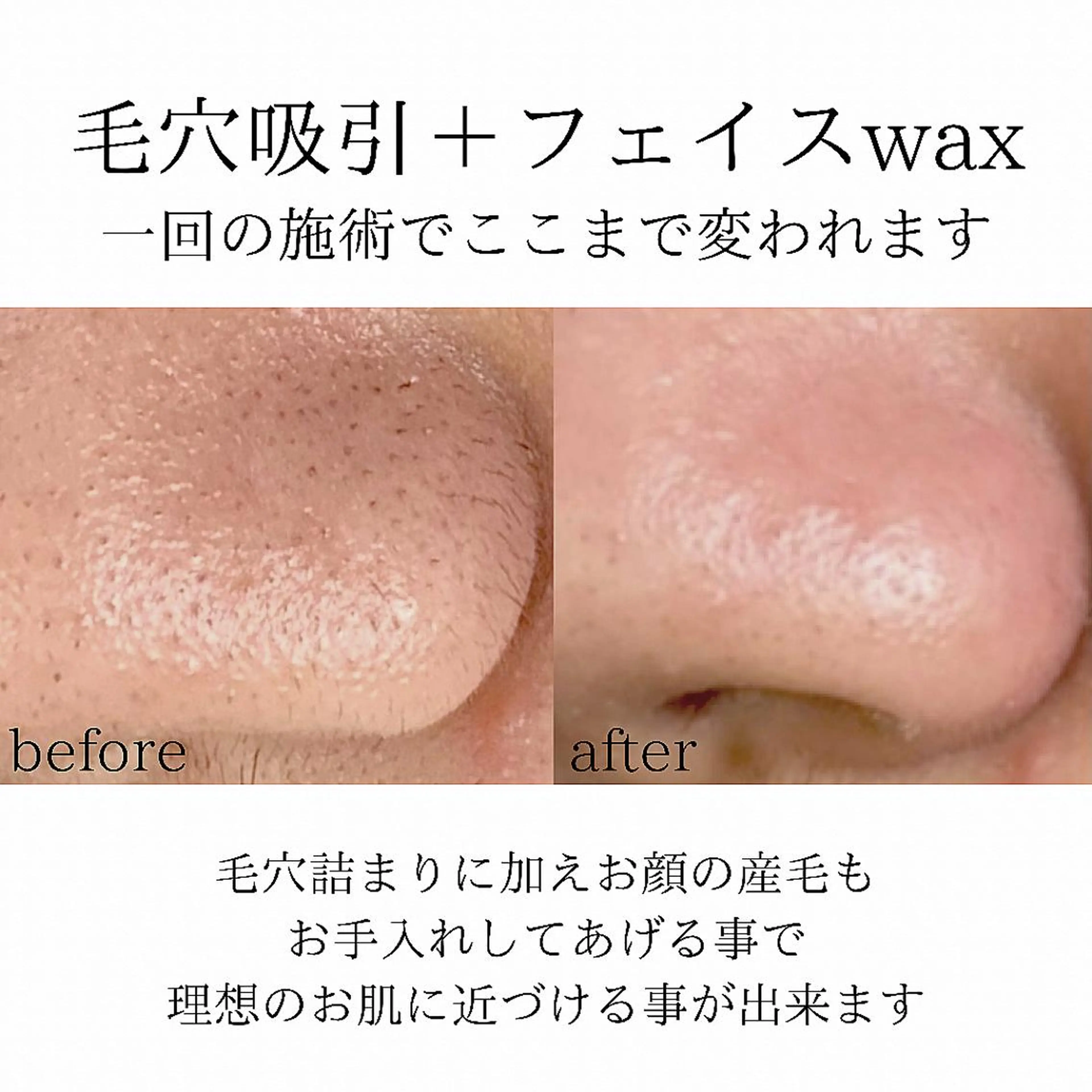 メンズ 脱毛 salonLADYSTYLE所属・稲嶺 美華のエステ・リラクイメージ