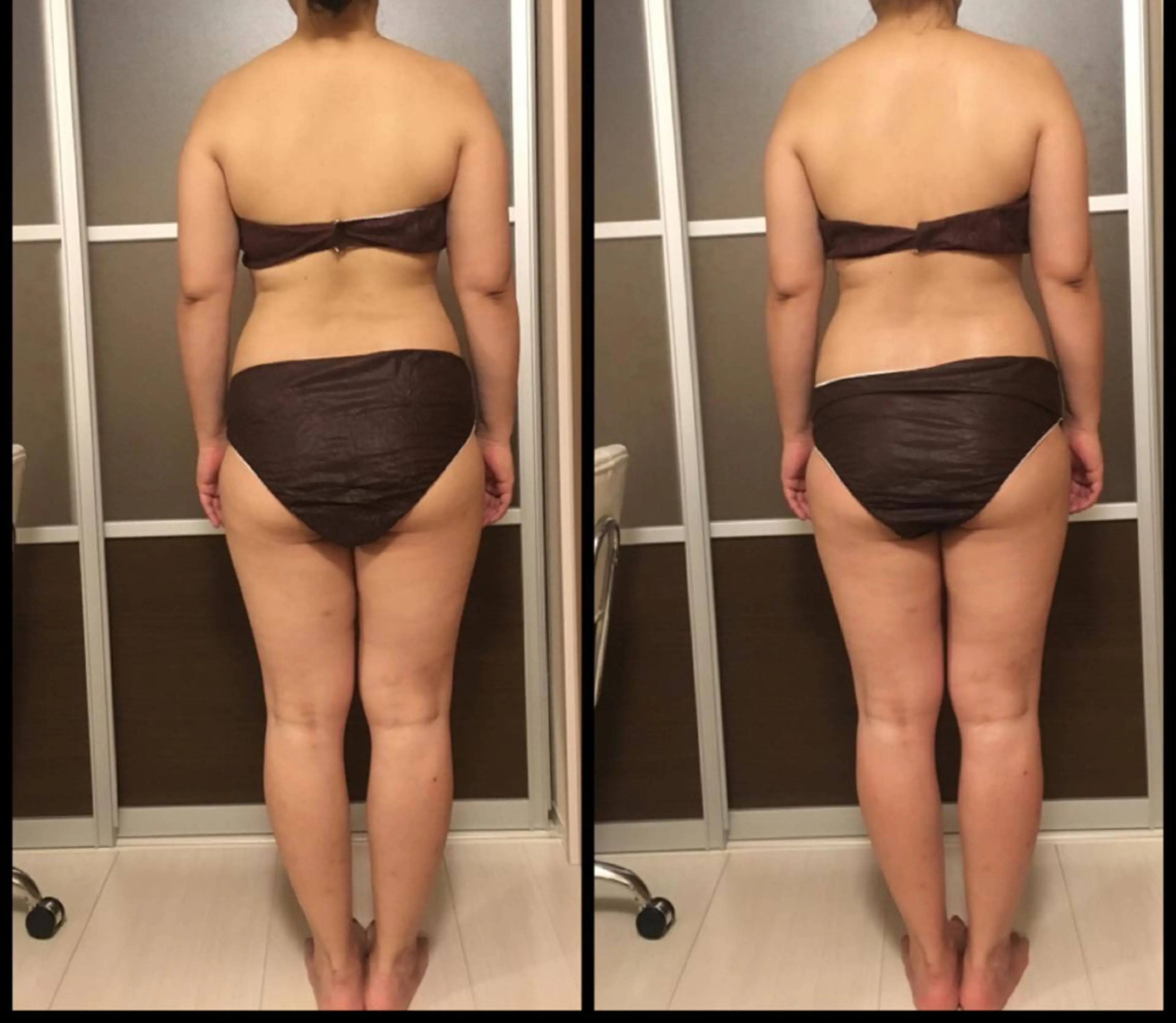 セミロング カラー パーマ ヘアアレンジ キッズ ネイル アニメ,Vオタク× 即効痩せエステサロンのエステ・リラクイメージ