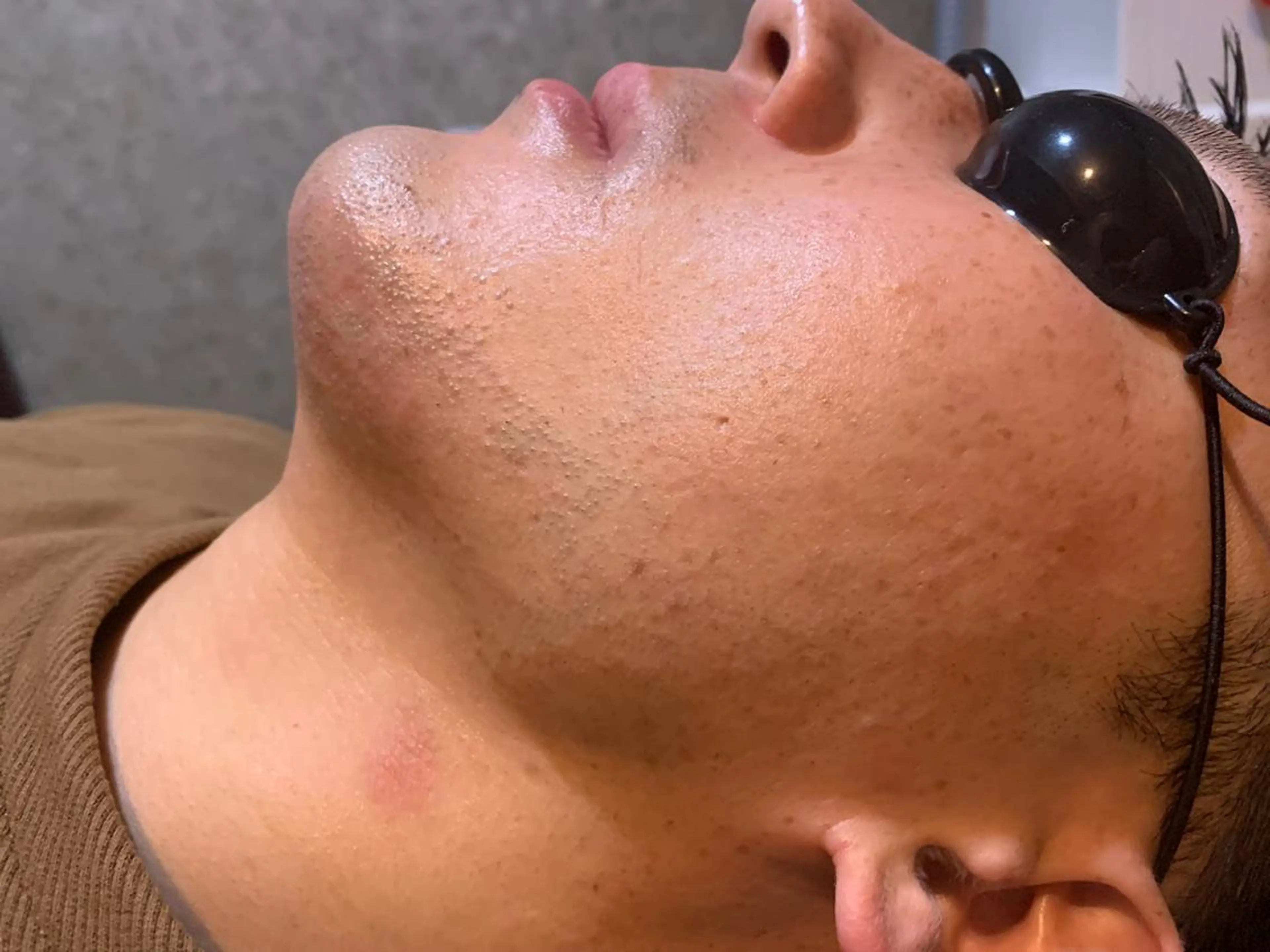 メンズ 20代から始める脱毛 salonLEPIAのエステ・リラクイメージ